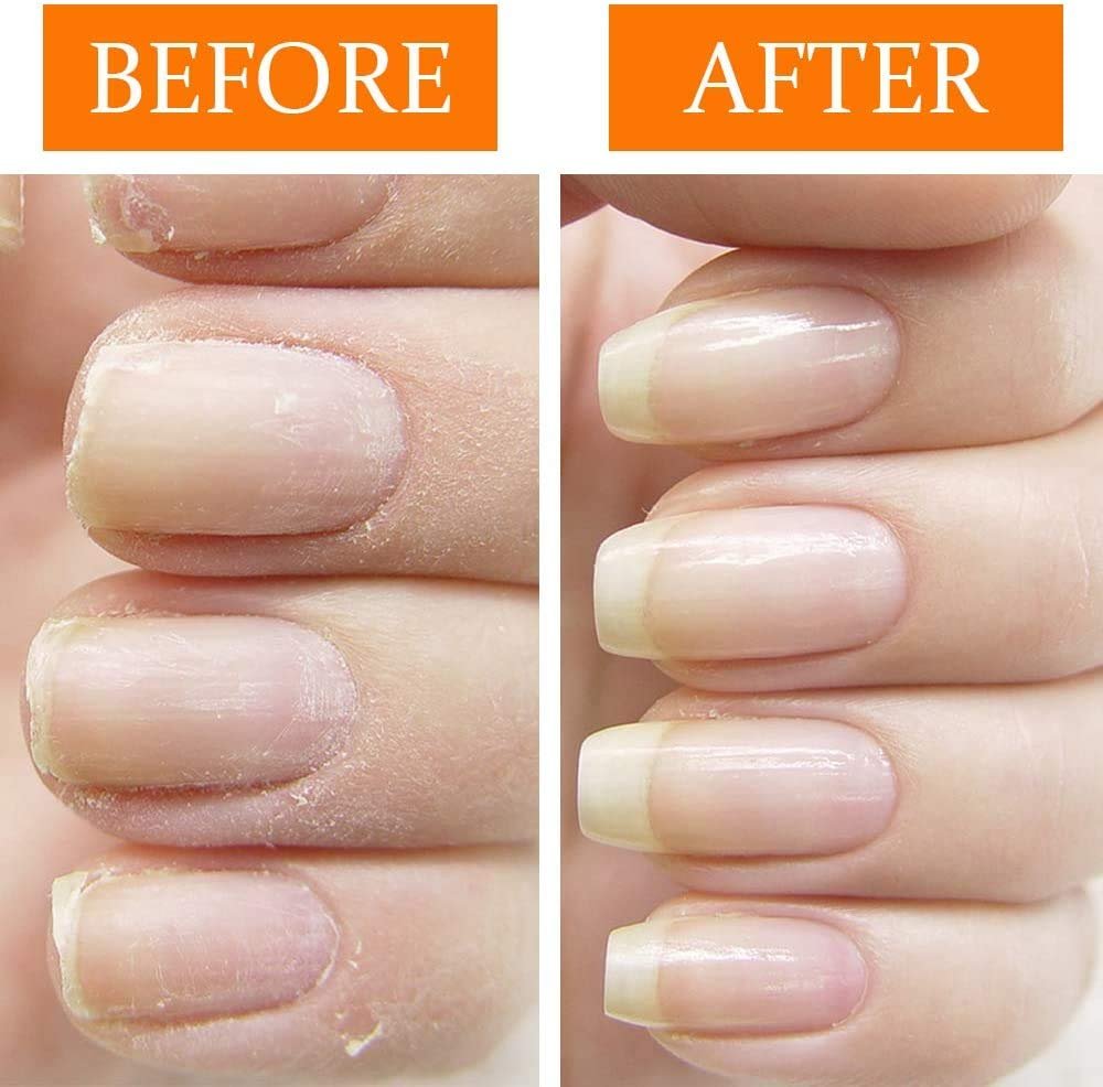 Nail Tek Repairs Damaged Nails kit.Intensive Therapy(.5OZ),Foundation(.5OZ)& Renew(.48OZ) - Image 5