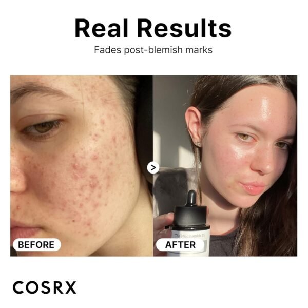 COSRX Niacinamide 15% Face Serum, Minimize Enlarged Pores, Redness Relief, Discoloration Correcting Treatment, 0.67 fl.oz/20 ml, Not Tested on Animals, Korean Skincare - Image 5