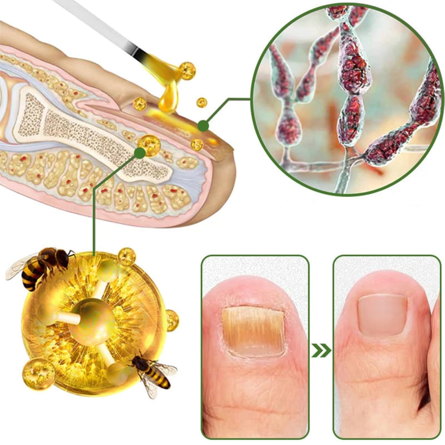 Furzero Nail Defense Bee Venom Treatment Serum,Nail Growth and Repair Serum,Nail Strengthener for Thin Nail, Brittle & Damaged Strengthener Base Coat Nail Polish Repair Nail Growth Treatment (1) - Image 4