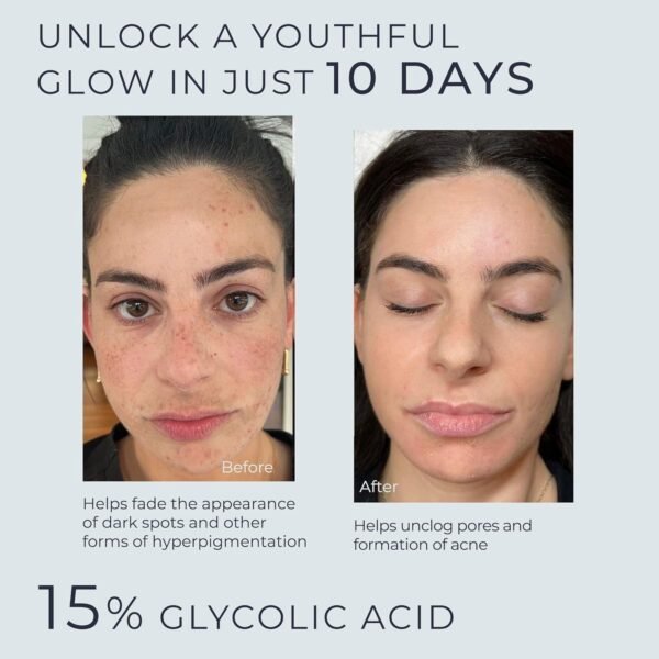 Glycolic Acid Serum for Face 15% Strength - Extra Large Size (2Oz) - Advanced Formula for Enhancing Skin Radiance, Texture Improvement, Addressing Uneven Tone & Fine Lines by InstaSkincare - Image 3
