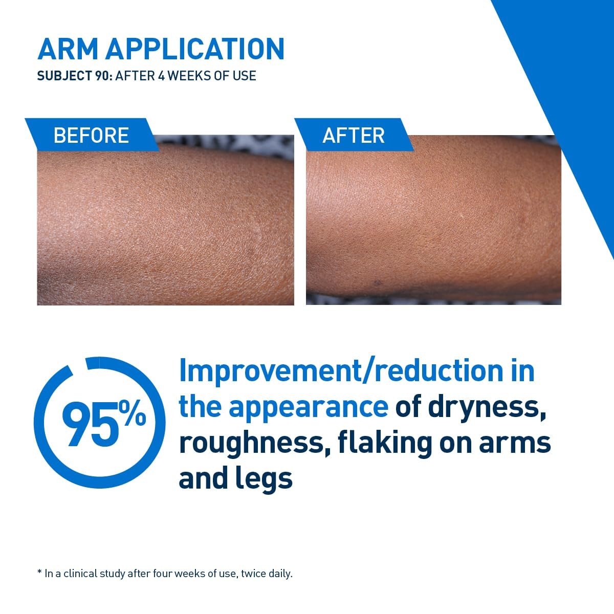 CeraVe Intensive Moisturizing Lotion | Hydro-Urea + Shea Butter | Body Lotion For Dry Skin | Relieves Signs Of Extra Dry Skin | Non Greasy Hydrating Lotion For Rough, Tight, Red & Itchy Skin | 16oz - Image 8