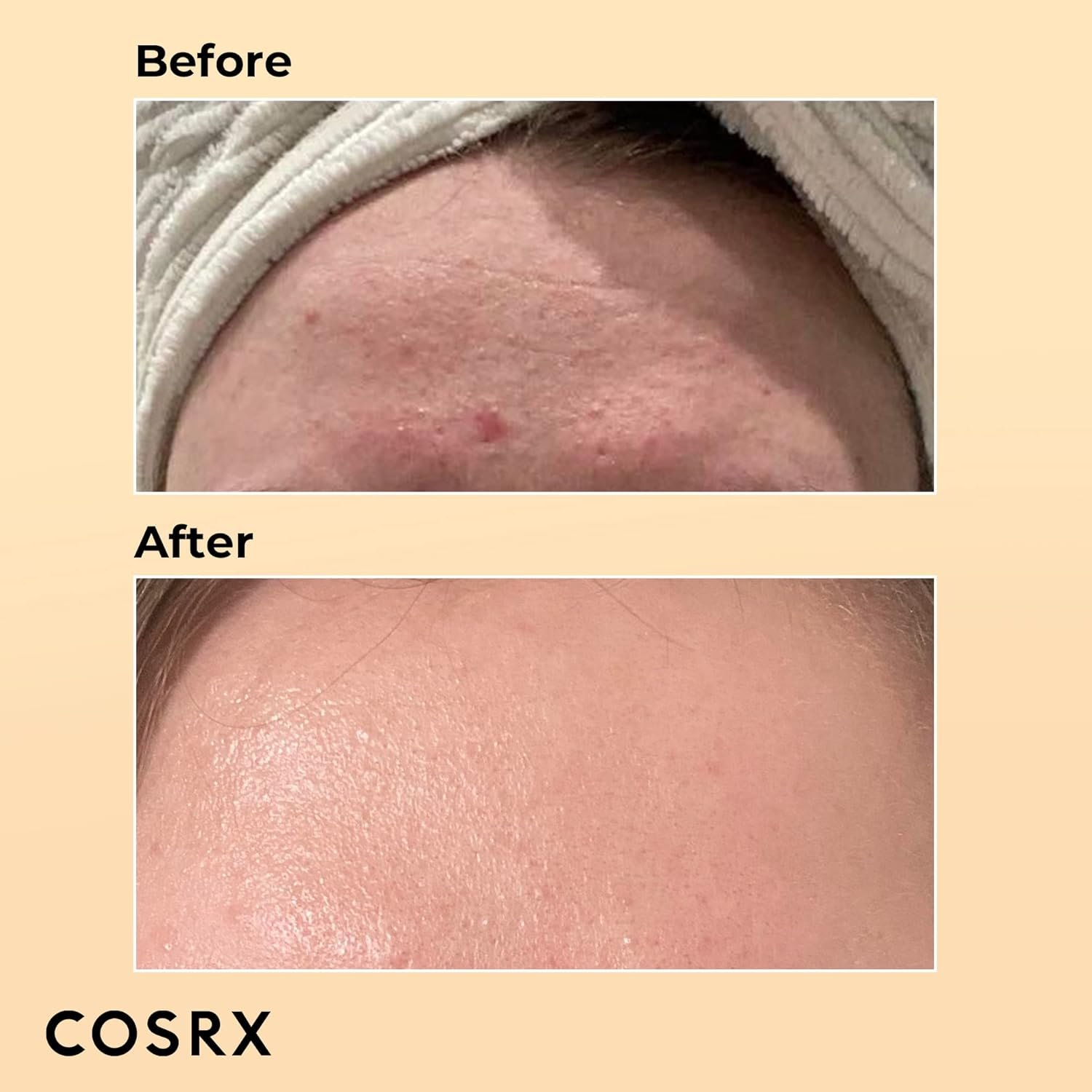 COSRX Post Acne Mark Recovery - Snail Mucin 96% Essence + Vitamin C 23% Serum, Intensive Hydrating for Fine lines, Hyperpigmentation, After Blemish Care - Image 8