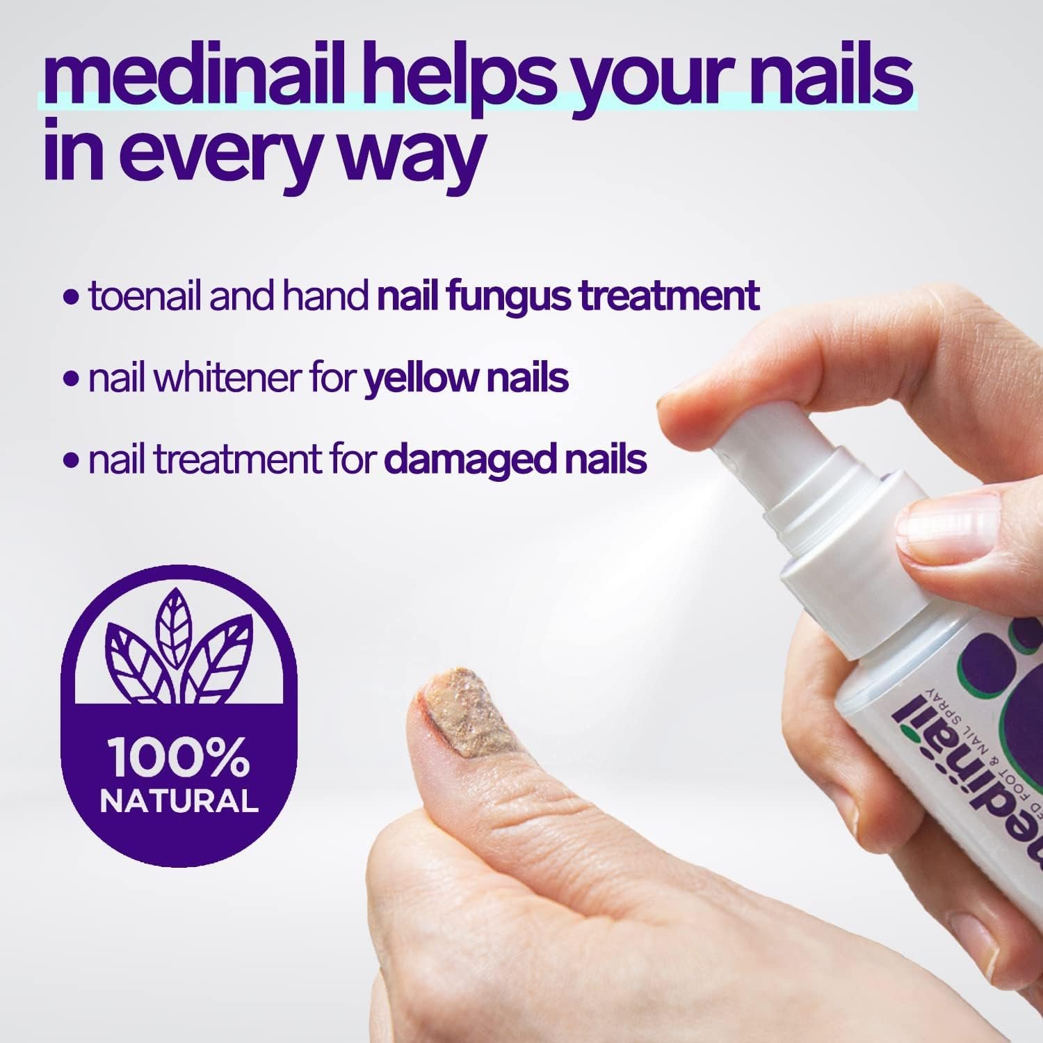 Medinail Toenail Fungus Treatment, Advanced Foot and Nail Spray, Hand and Toenail Repair Spray and Nail Strengthener (20.28 Fl Oz (Pack of 6)) - Image 5