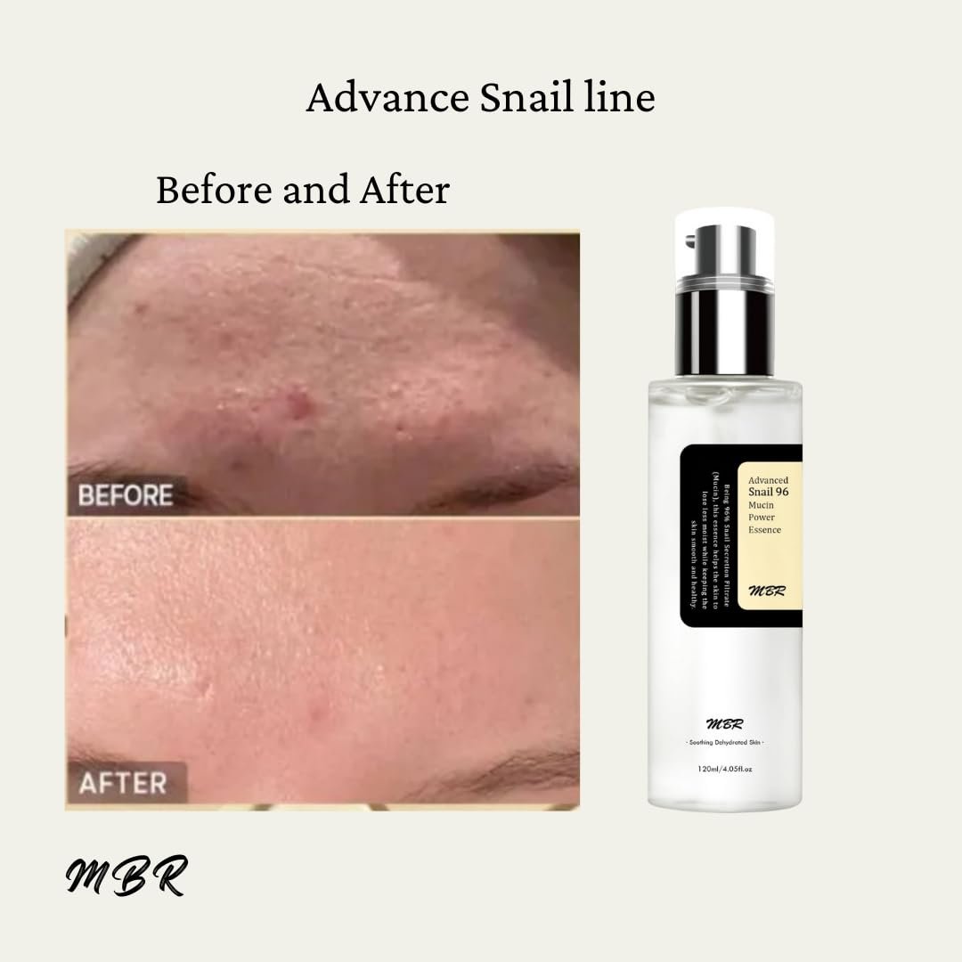 Advanced Snail Mucin 96% Power Repairing Essence - Hydrating Serum for Face with Snail Secretion Filtrate (4.05 fl.oz / 120ml) - Image 5