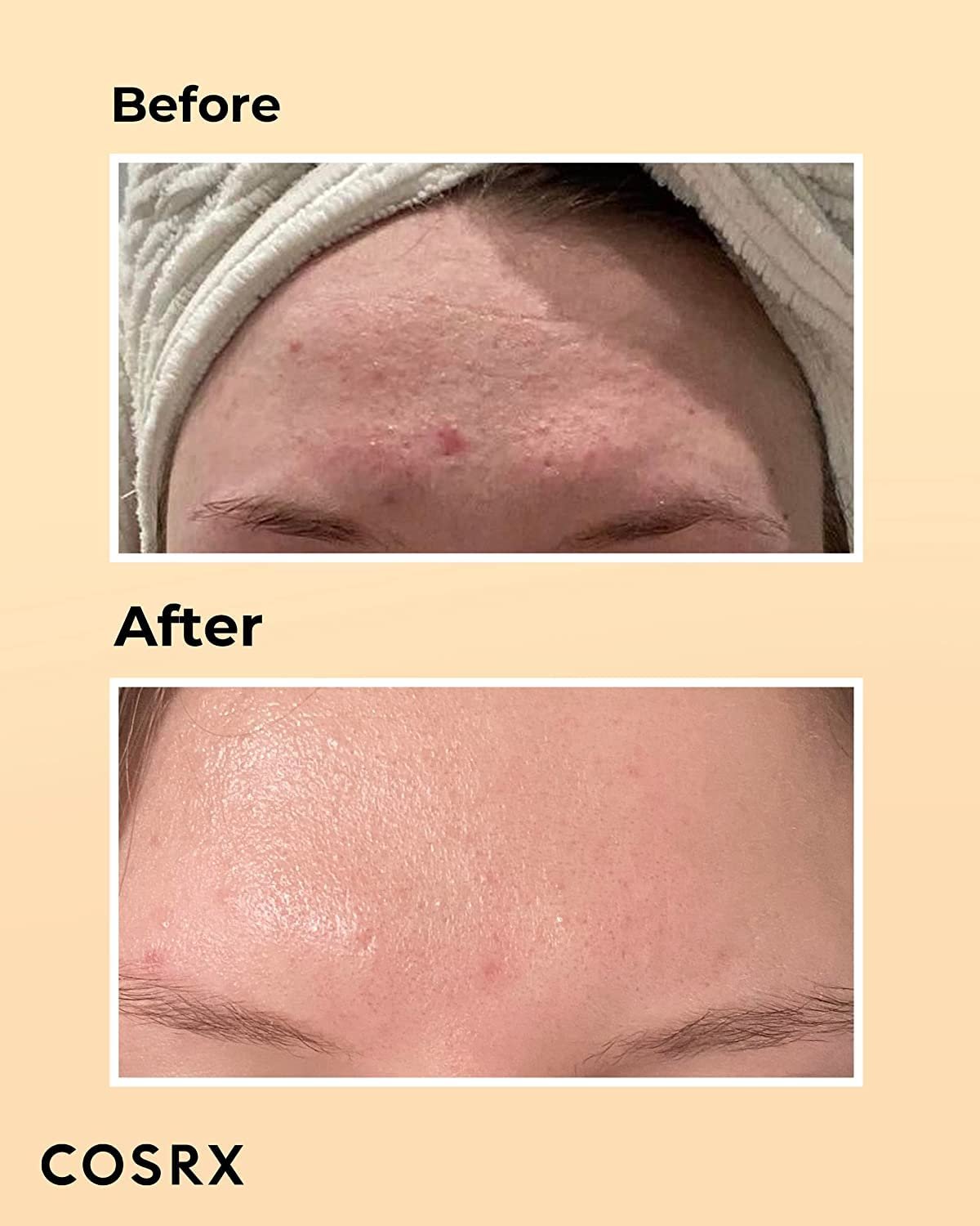 COSRX Post Acne Mark Recovery - Snail Mucin 96% Essence + Vitamin C 13% Serum, Intensive Hydrating for Fine lines, Hyperpigmentation, After Blemish Care - Image 4