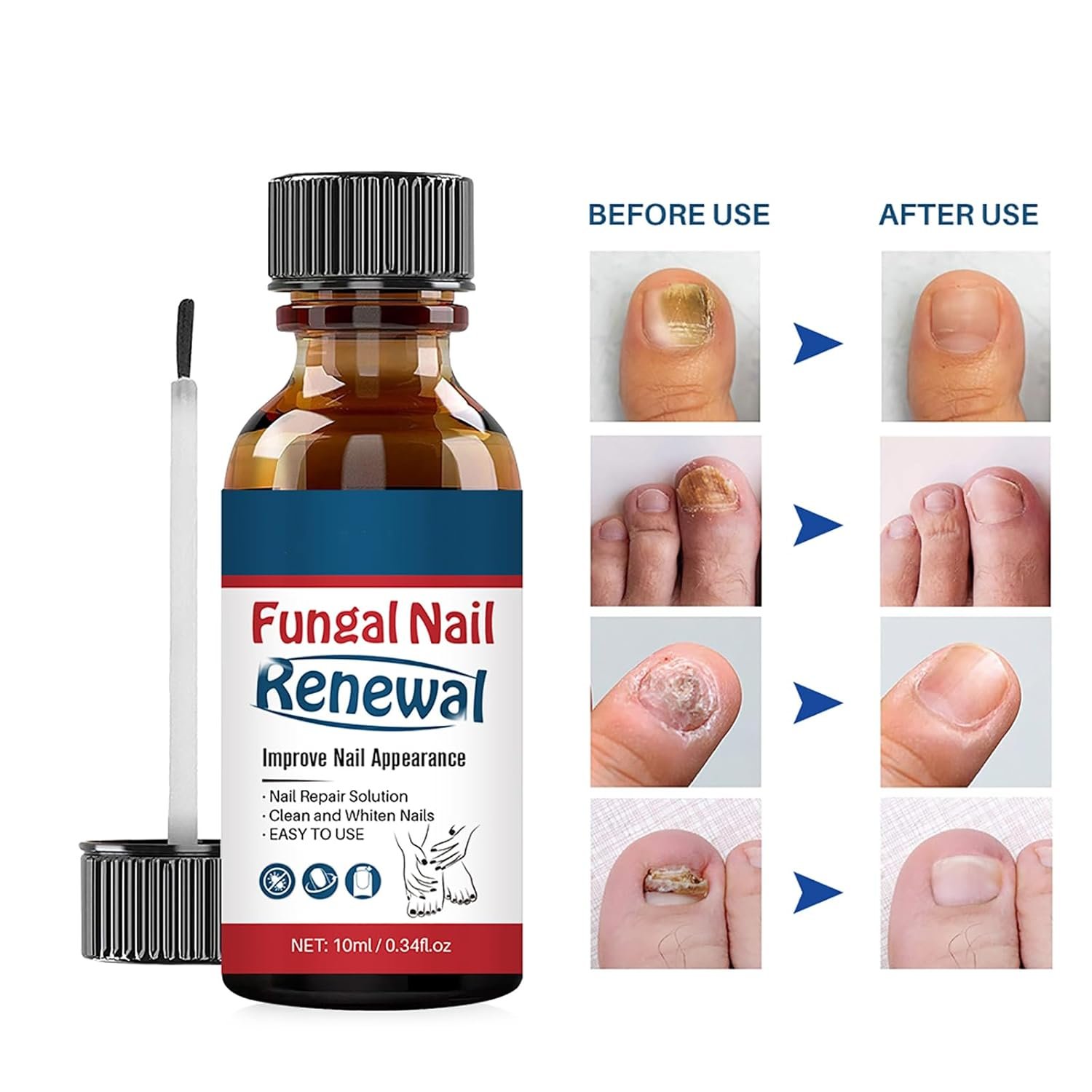 Nail Repair Essnce Liquid, Fingernail and Toenail Repair, Fix & Renew Damaged, Broken, Cracked & Discolored Nails, Reduce Nail Thickening, Strengthen Nails for Beautiful Nail - Image 7