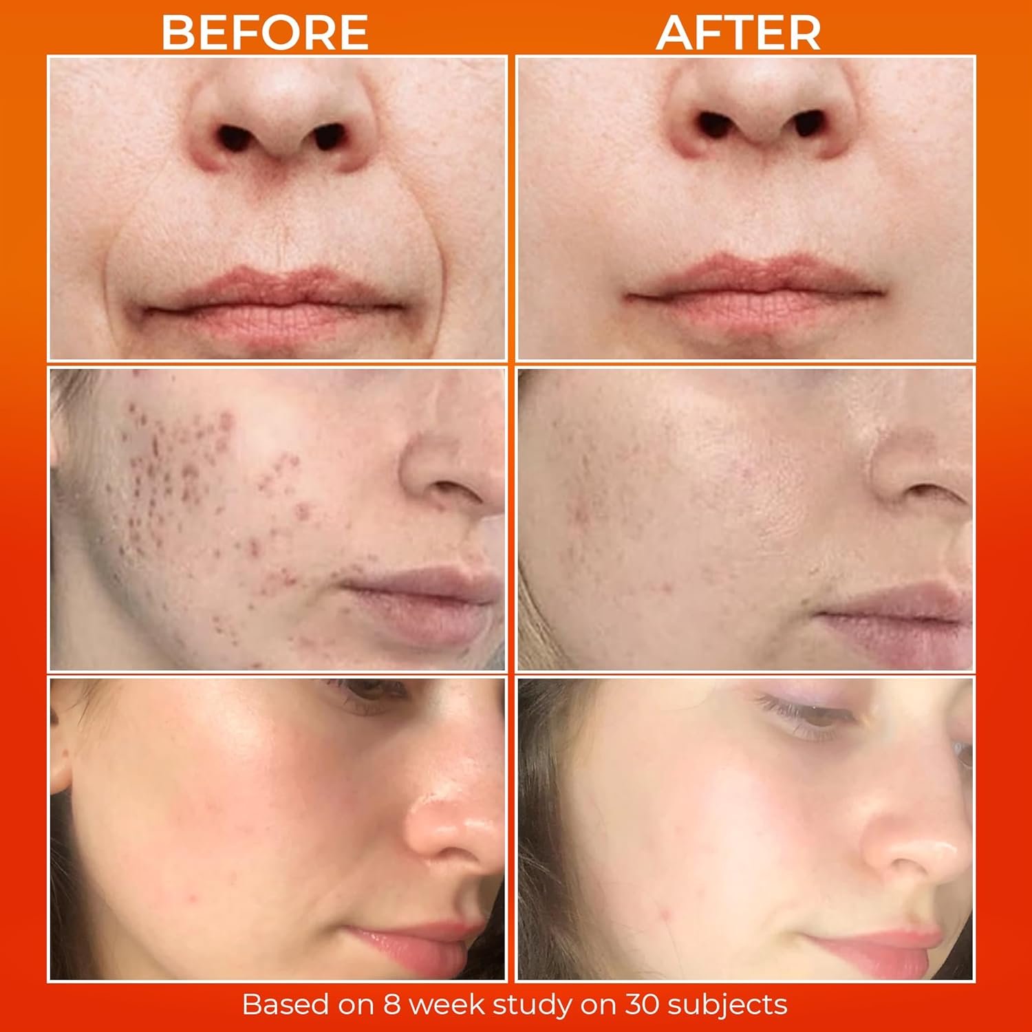 Dr Crazy Millionaire Glow Serum | Snail Mucin + Vitamin C Serum | Face Serum for Women | Jojoba Oil + Vitamin E Serum | Vitamin C Serum for Face | 30ml - Image 5