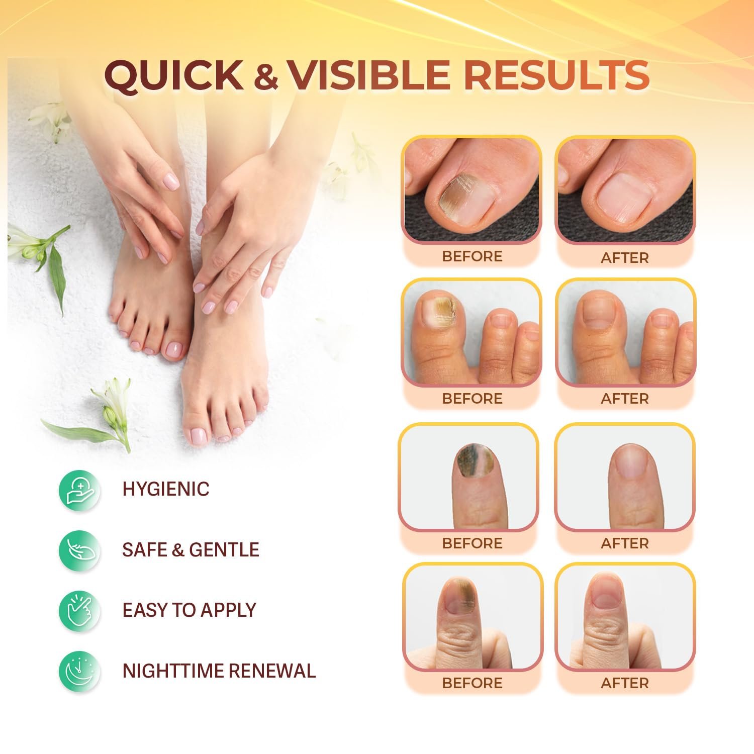 Fungal Nail Patches: Nail Fungus Relief - Toenail Fungus Relief - Nighttime Renewal Fungal Nail Patches - Nail Fungus Improvement - Overnight Nail Repair - 8-Hour Nighttime Renewal - 21 PCS - Image 5
