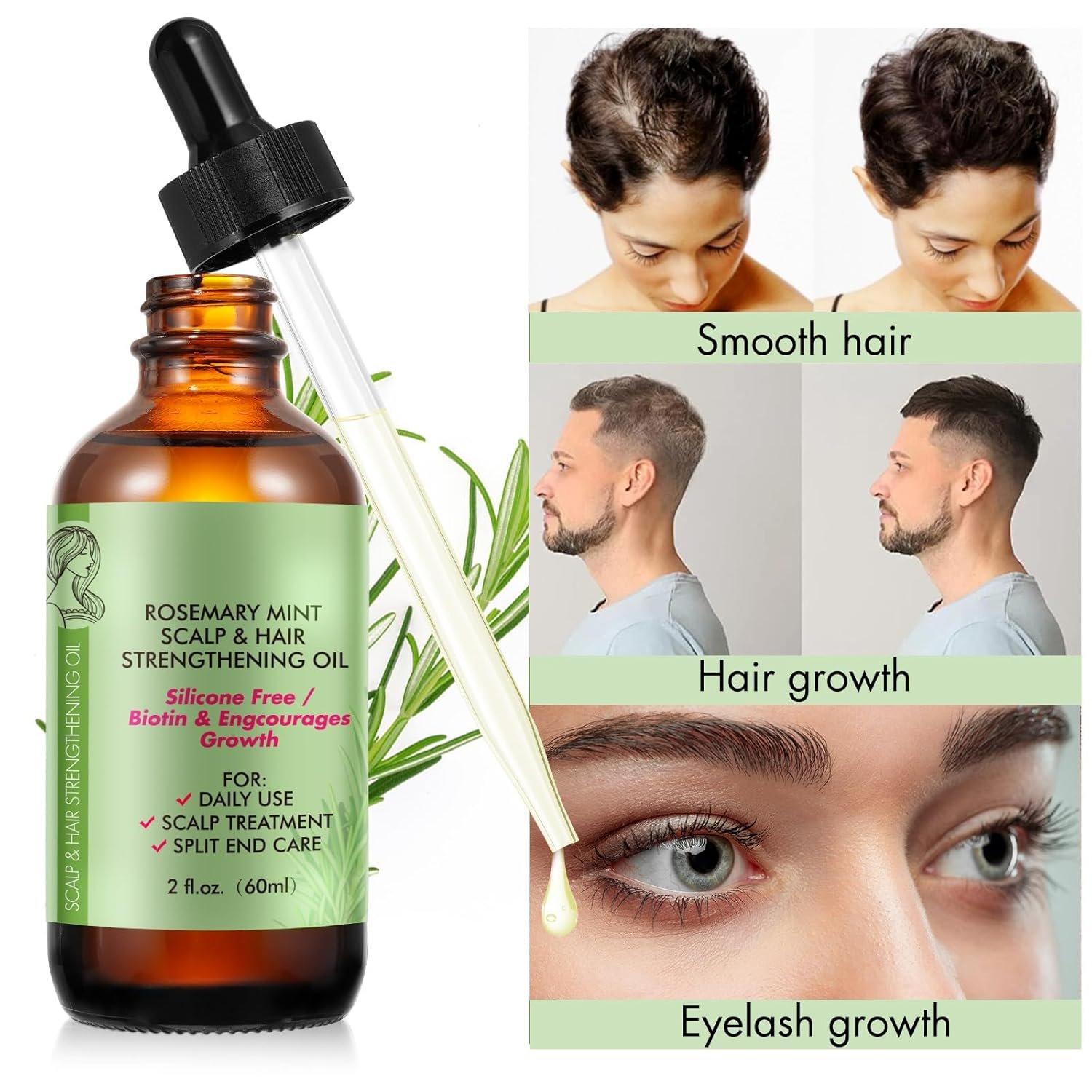 Rosemary Oil (2 Pack) for Hair Growth & Skin Care, 100% Pure Natural Oil for Thicker Stronger Hair, Suitable for All Hair Types - Image 4
