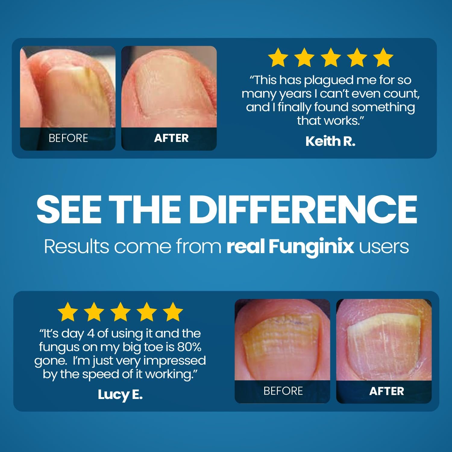 FUNGINIX Toenail Fungus Treatment - Extra Strength - Nail Fungus Treatment & Athlete's Foot Solution - Antifungal Liquid Solution - Made In the USA - 1 Bottle - (Packaging May Vary) - Image 5