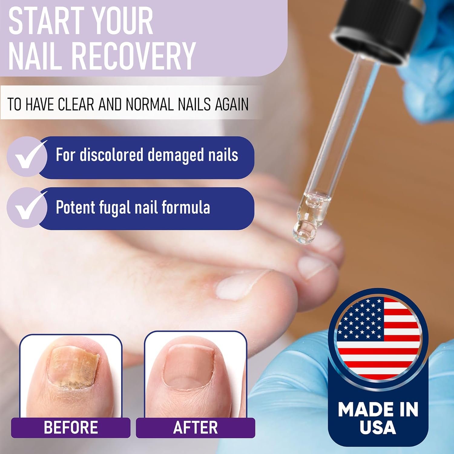Extra Strength Toenail & Fingernail Repair Drops - Nail Care Renewal for Thick, Damaged & Discolored Nails - 2 Pack - Image 3