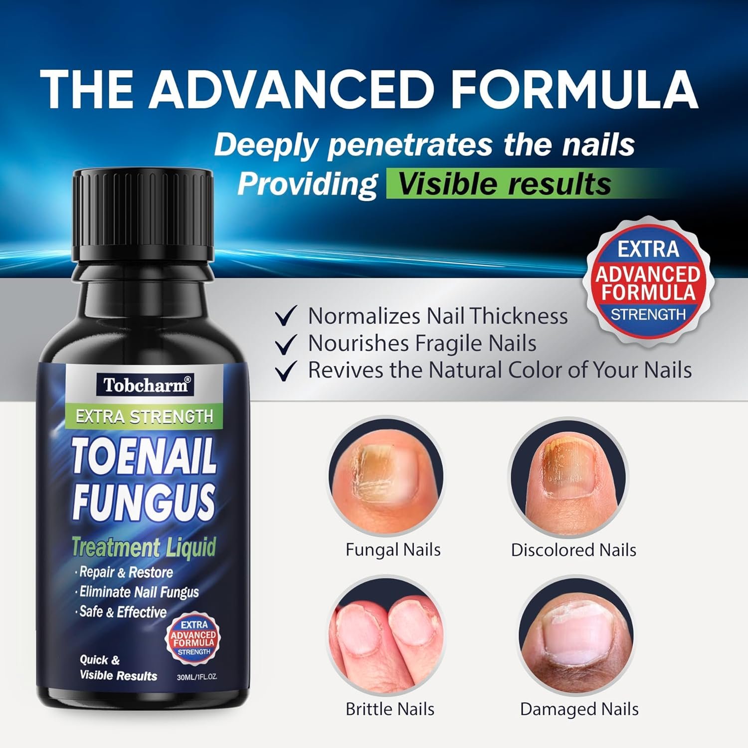 Toenail Fungus Treatment Extra Strength, Nail Fungus Treatment for Toenail, Fungus Nail Treatment, Nail Fungus Treatment for Fingernails (1oz) - Image 3