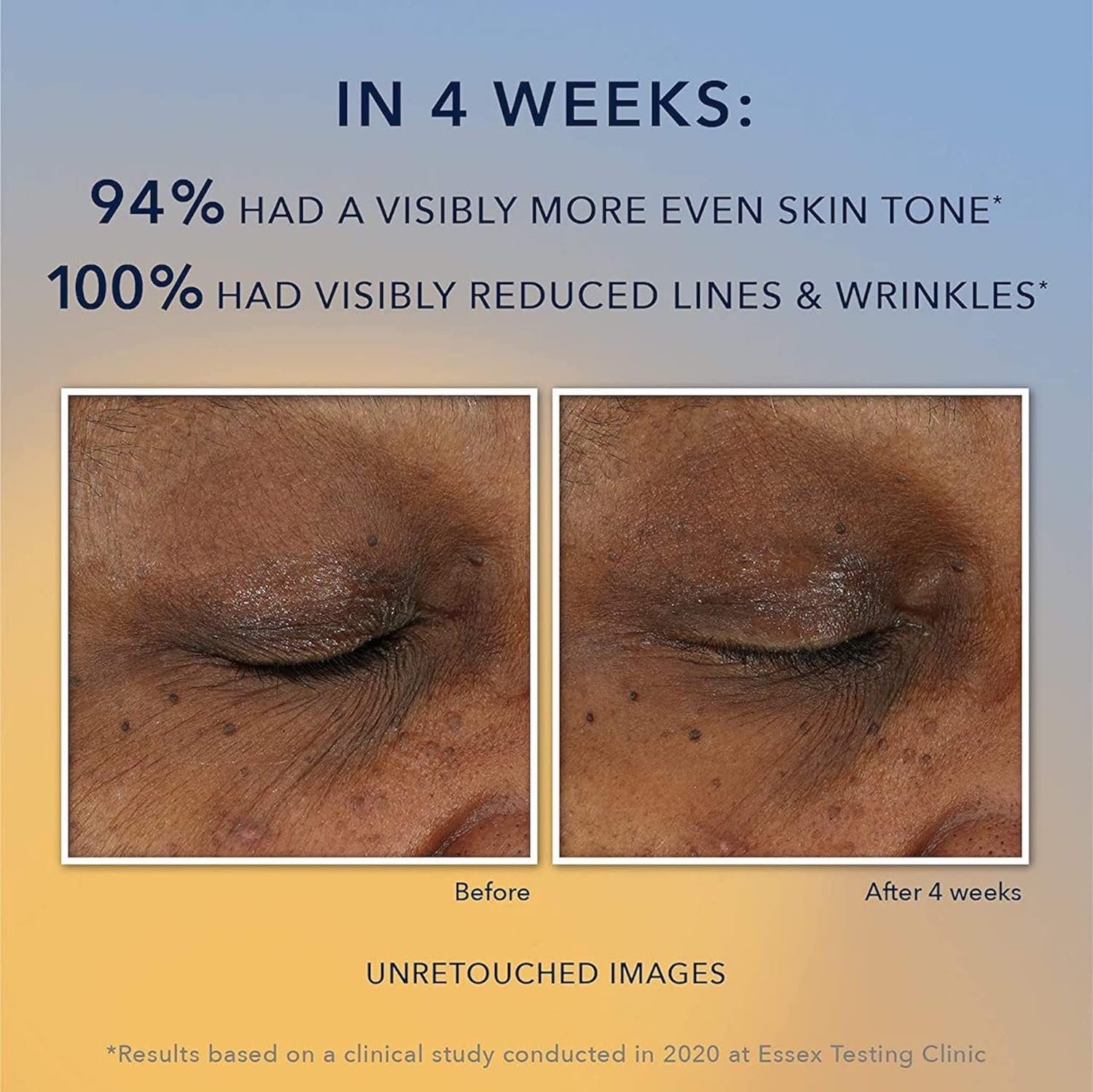 RoC Multi Correxion Revive + Glow 10% Active Vitamin C Serum for Face, Daily Anti-Aging Wrinkle and Skin Tone Skin Care Treatment, Brightening Serum, 1 Fluid Ounce - Image 4