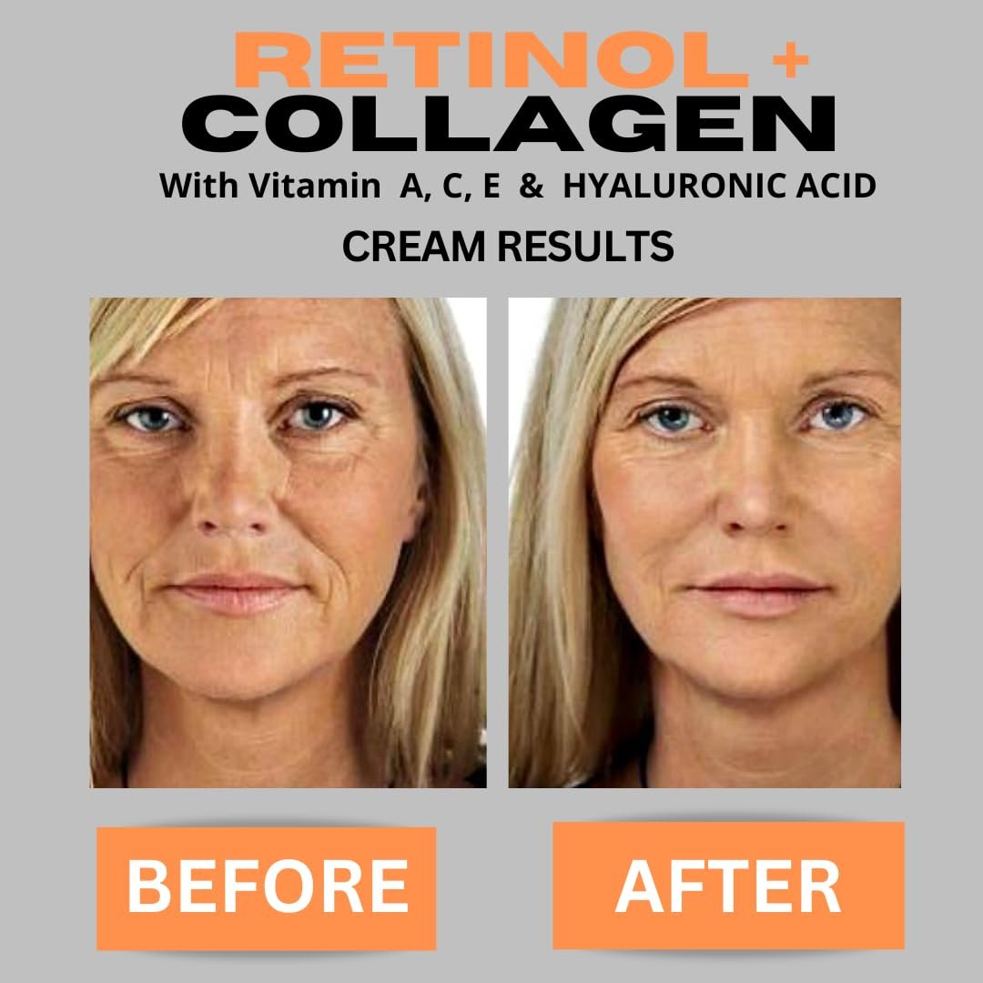 Retinol + Collagen, Hyaluronic Acid, Vitamin C Anti-Aging Face Cream, Day and Night Moisturizing Cream, Anti-Wrinkle Cream for Face, Firming Cream - 4oz - Image 3