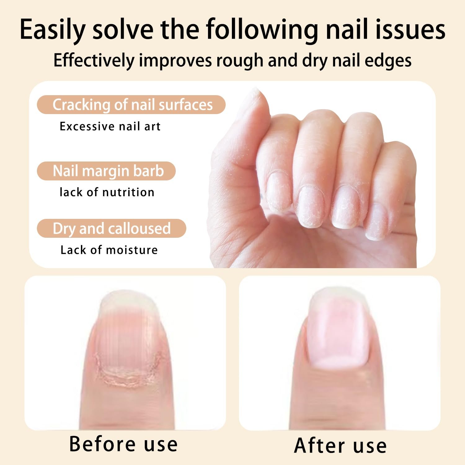 Cuticle Oil Pen Sweet Almond Nail Growth Serum and Repair Treatment Hydrating Oil for Dry Cuticles and Skin Cuticle Buddy Revitalize Nails with Radiant Nail Growth Oil (6pcs pens) - Image 4