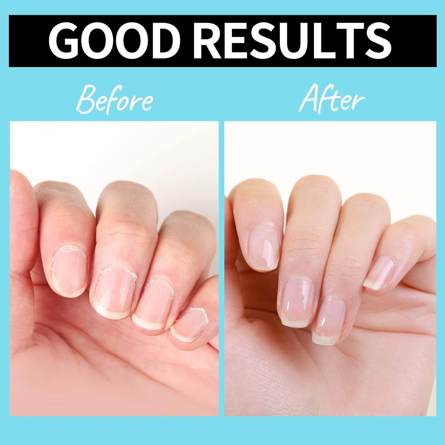 Teenitor Cuticle Care kit with Cuticle Remover and Cuticle Oil, Cuticle Softner and Cuticle Revitalizing Oil, Cuticle Remover Oil - Image 9