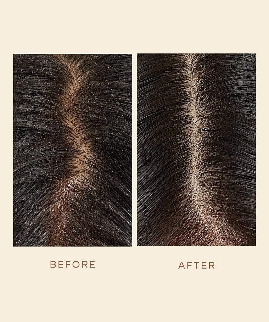VEGAMOUR GRO Scalp Detoxifying Serum, Scalp Serum with Zinc PCA Removes Buildup & Soothes Scalp, Natural Citrus Scent, 2 fl. oz. - Image 6