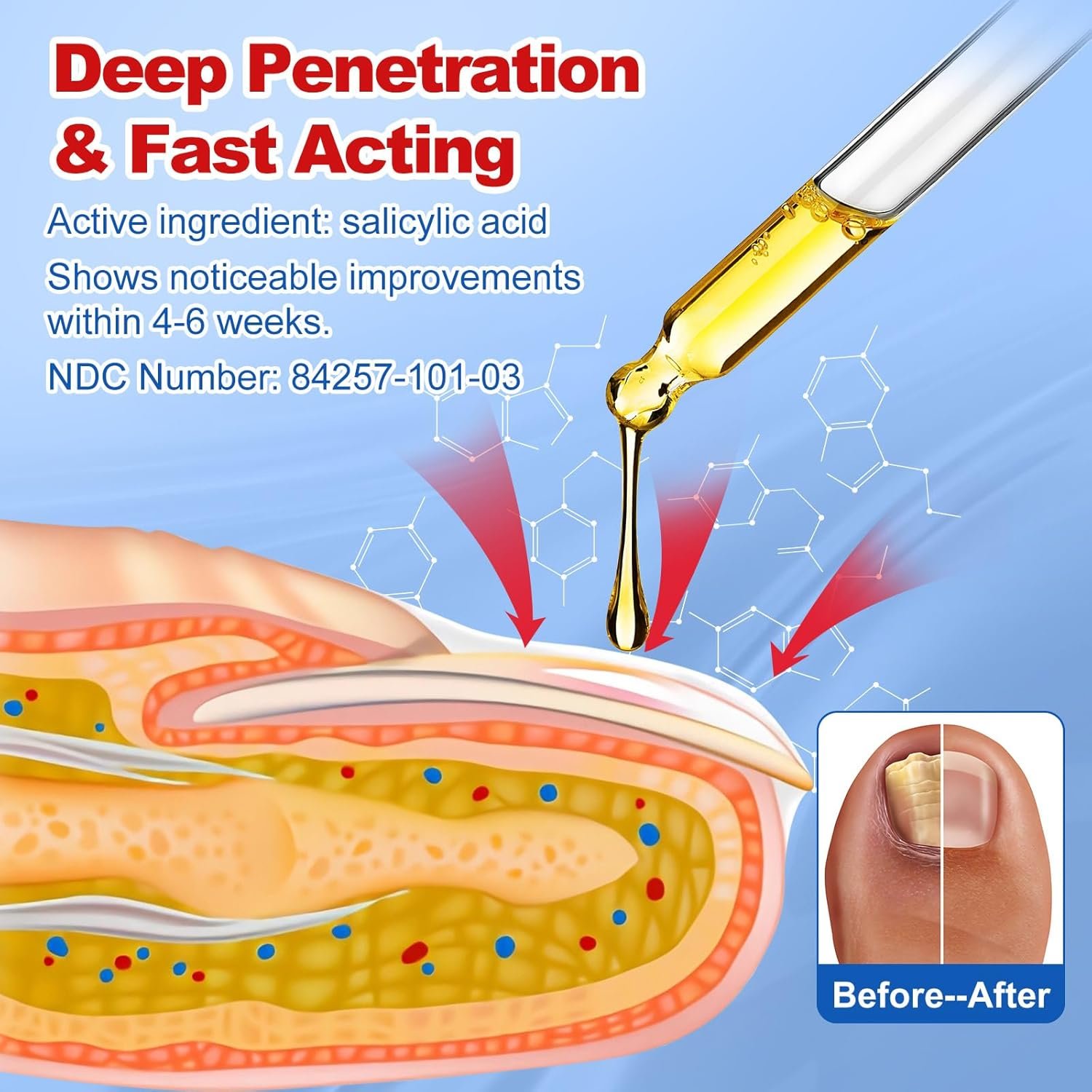 Toenail Fungus Treatment, Extra Strength Nail Fungus Remover, Toe Fingernail Repair Liquid Solution Fast Acting for Woman and Man - 30mL(1 fl oz) - Image 3