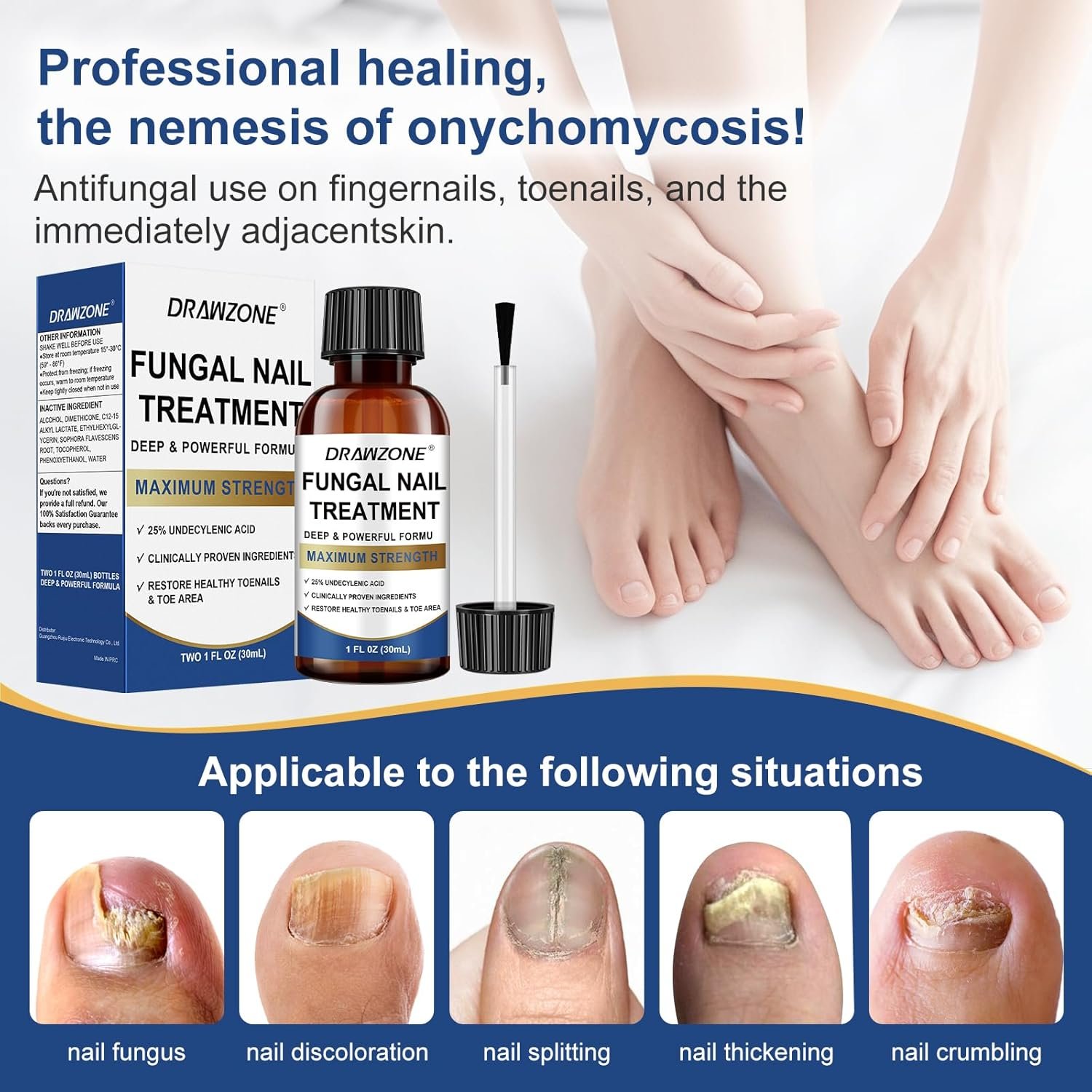 Toenail Fungus Treatment Extra Strength with 25% Undecylenic Acid, Ingrown toenail treatment, nail repair, Fungus nail treatment, yellow toenail, Damaged Nails foot fungus treatment extra strength - Image 3