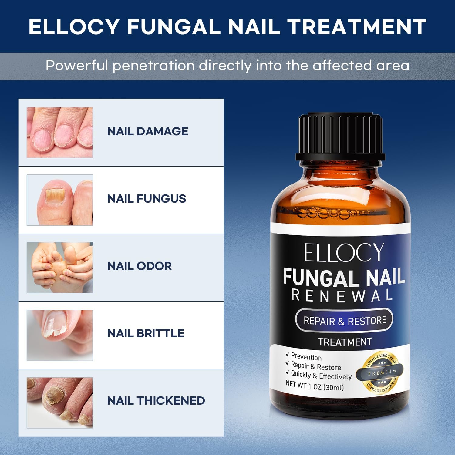 Toenail Fungus Treatment Extra Strength: Repair Damaged Toenail and Fingernail Fungus Treatment - Nail Repair Liquid 30ml - Image 3