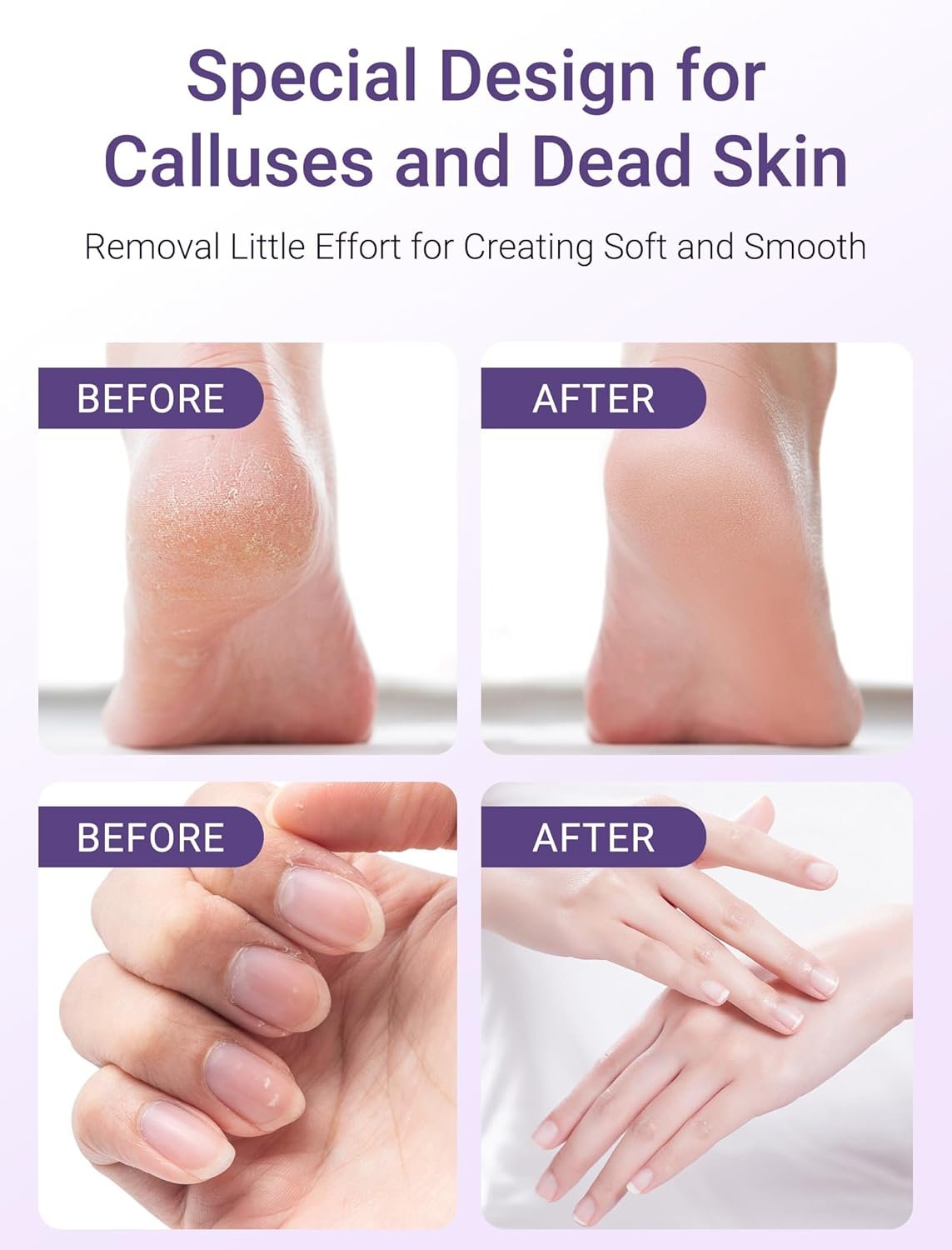 Melodysusie PC500D Foot File Callus Remover, Portable Electric Foot File Pedicure Tools, Professional Foot Scrubber for Dead Skin, Hard Cracked Dry Skin, Foot Scraper for Women - Image 5