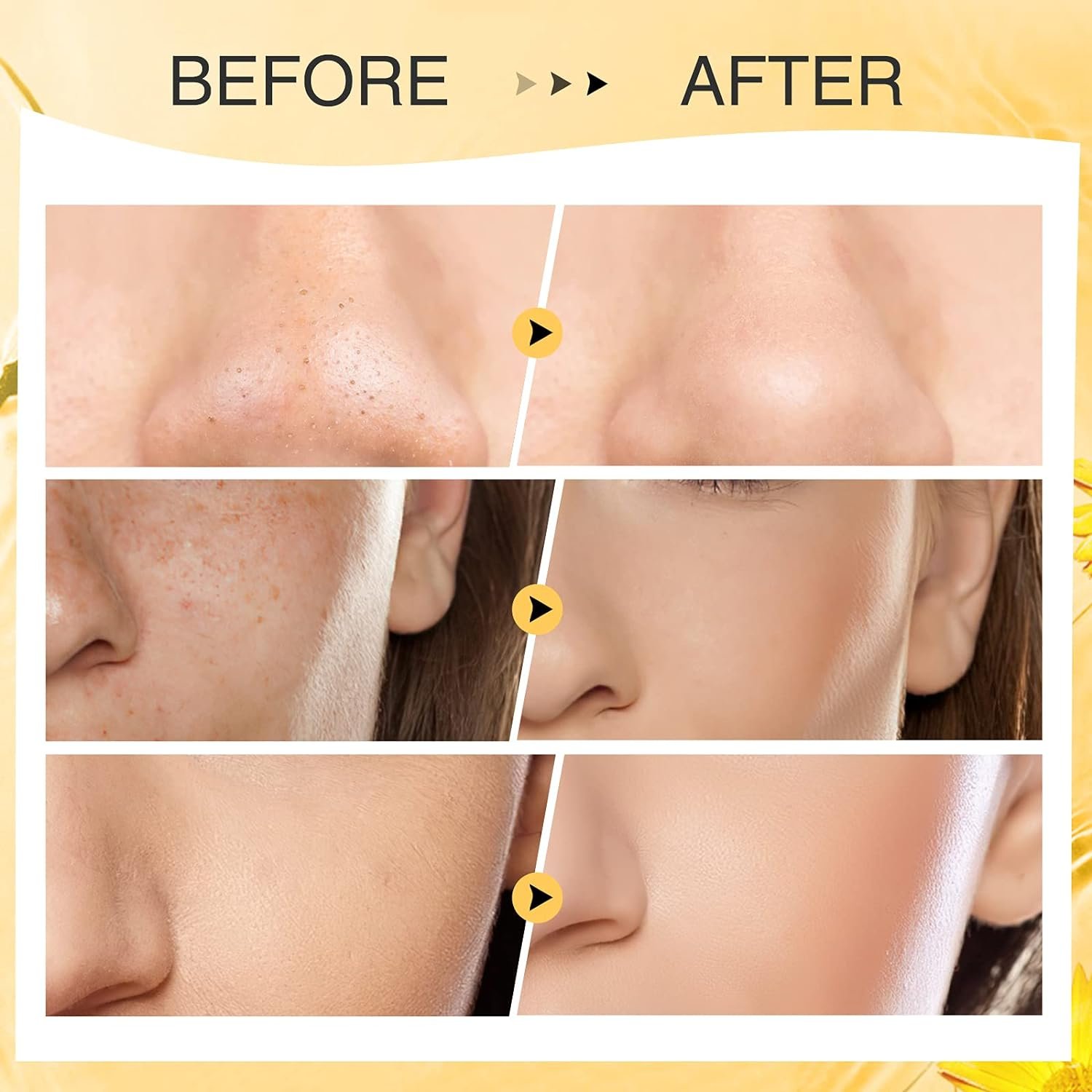Turmeric Clay Stick Mask Organic Vitamin C Purifying Mask for Blackhead Cleansing Healing Clay Mud Mask for Deep Clean Pore Improve Skin Acne Scars Facial Mask With Blackhead Remover Extractor Tools - Image 6