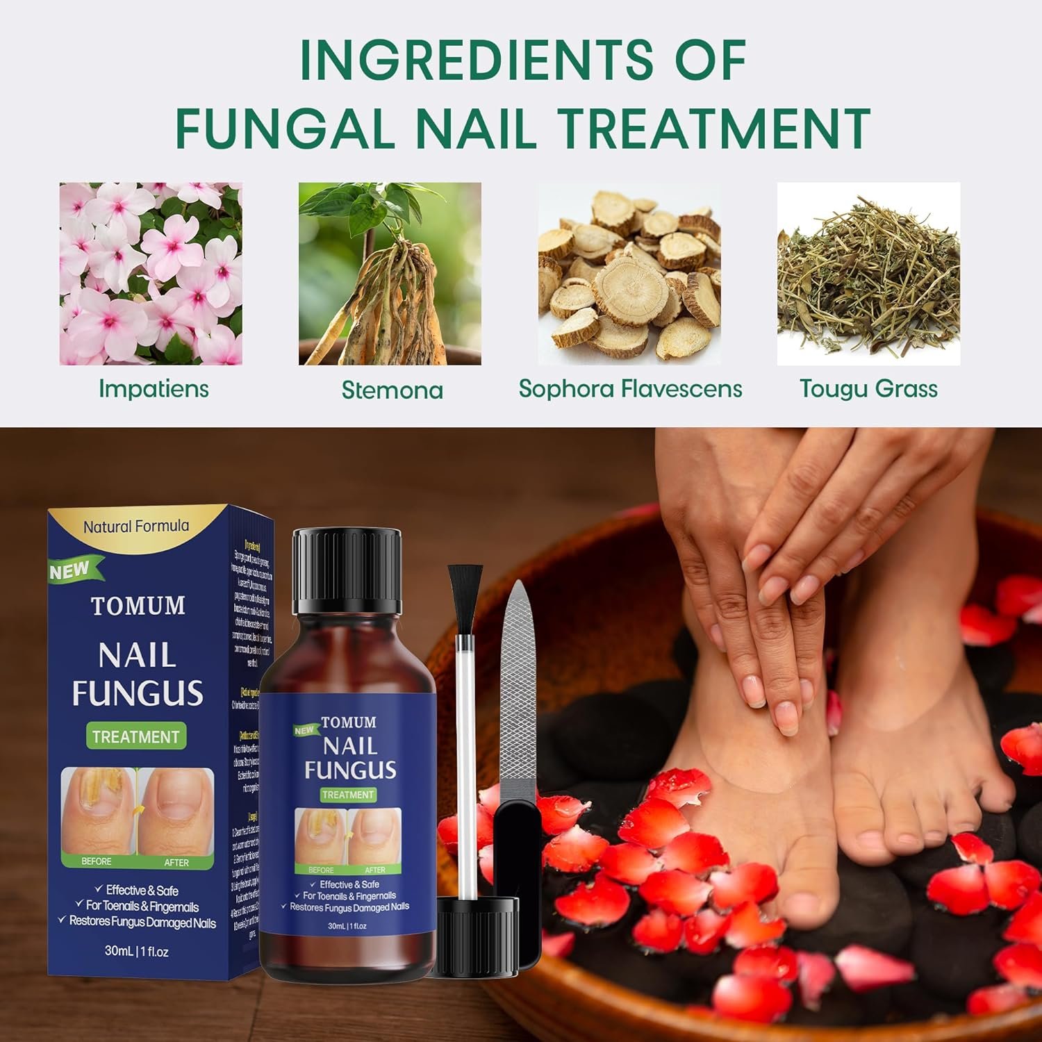 Toe finger nail fungus treatment: Hongos fungal remover extra strength liquid - finger nail fungi aid care kit - fungus nail repair with brush - (30ml/1fl oz) - Image 6