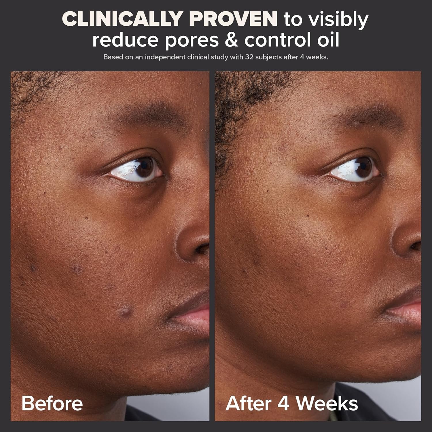 Paula's Choice SKIN PERFECTING 2% BHA Liquid Salicylic Acid Exfoliant-Facial Exfoliant for Blackheads, Enlarged Pores, Wrinkles & Fine Lines - Image 4