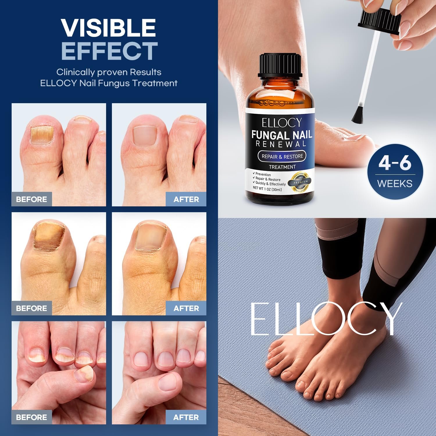 Toenail Fungus Treatment Extra Strength: Repair Damaged Toenail and Fingernail Fungus Treatment - Nail Repair Liquid 30ml - Image 6