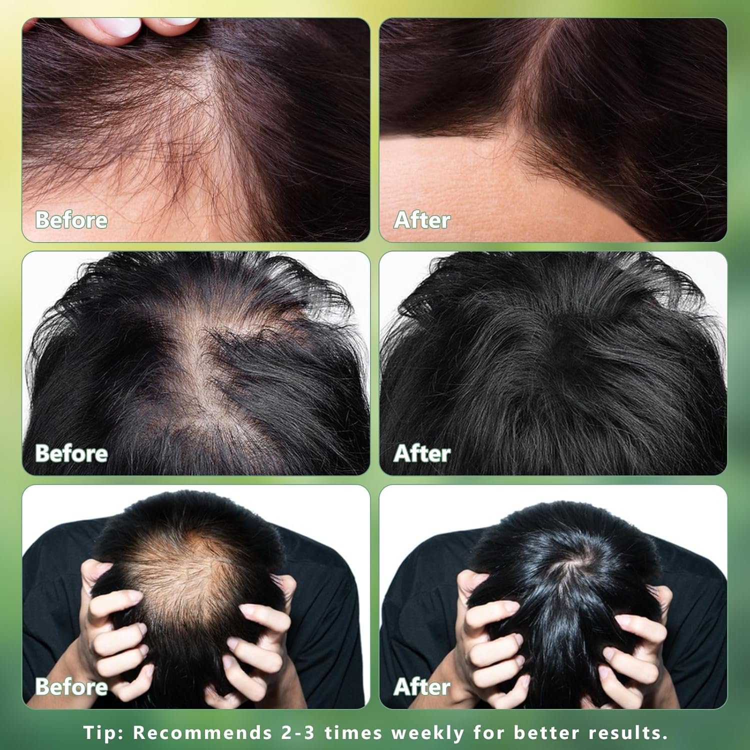 Rosemary Oil for Hair Growth,Organic Rosemary Hair Oil for Thin Hair Eyebrows Beard,100% Natural Rosemary Ointment with Batana for Skin Care Body Massage,Men and Women(4.23 Floz/120ml) - Image 6