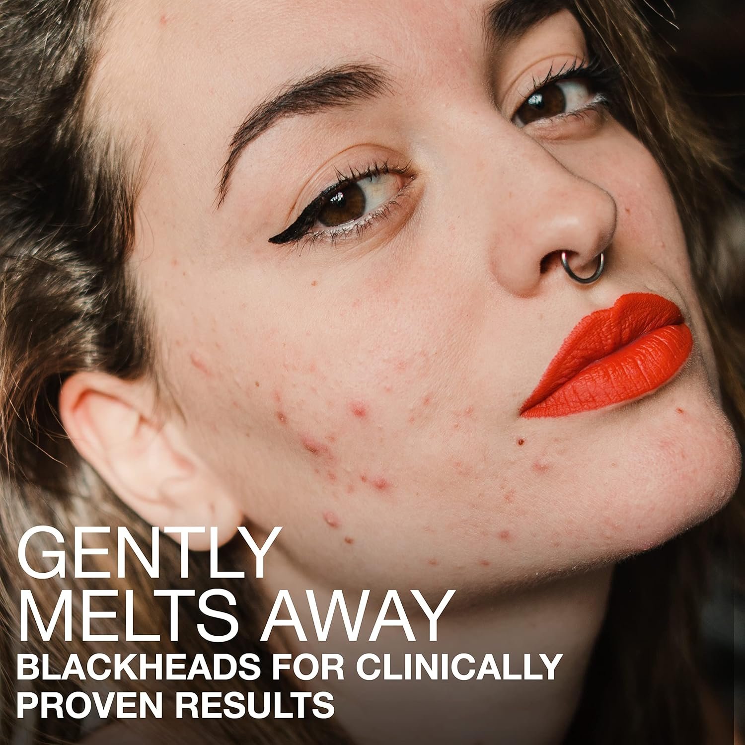 Neutrogena Stubborn Blackheads Daily Acne Facial Serum with Salicylic, Glycolic, Polyhydroxy & Mandelic Acids, Oil-Free Face Serum for Acne-Prone Skin to Help Clear Clogged Pores, 1 fl. oz - Image 5