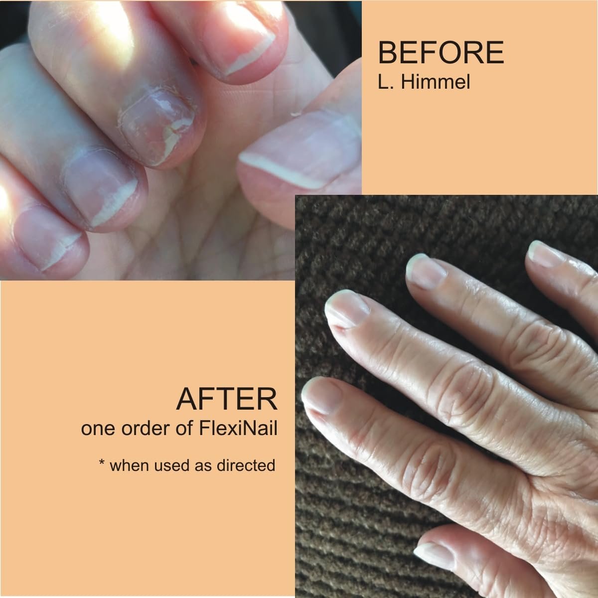 Penetrating Fingernail Conditioner and Strengthener to repair and then maintain weak and peeling or brittle and splitting nails - Image 4