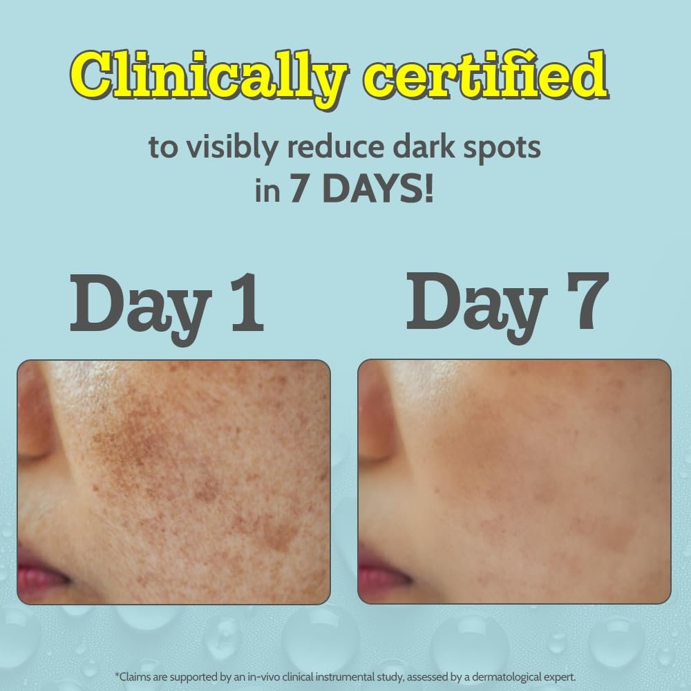 10% Vitamin C Face Serum |Brightens & Gives Glow |Fades Dark Spots |Treats Hyperpigmentation| Balances Melanin Production | Ethyl Ascorbic Acid & Glucosamine | For All Skin Types 30ml - Image 4