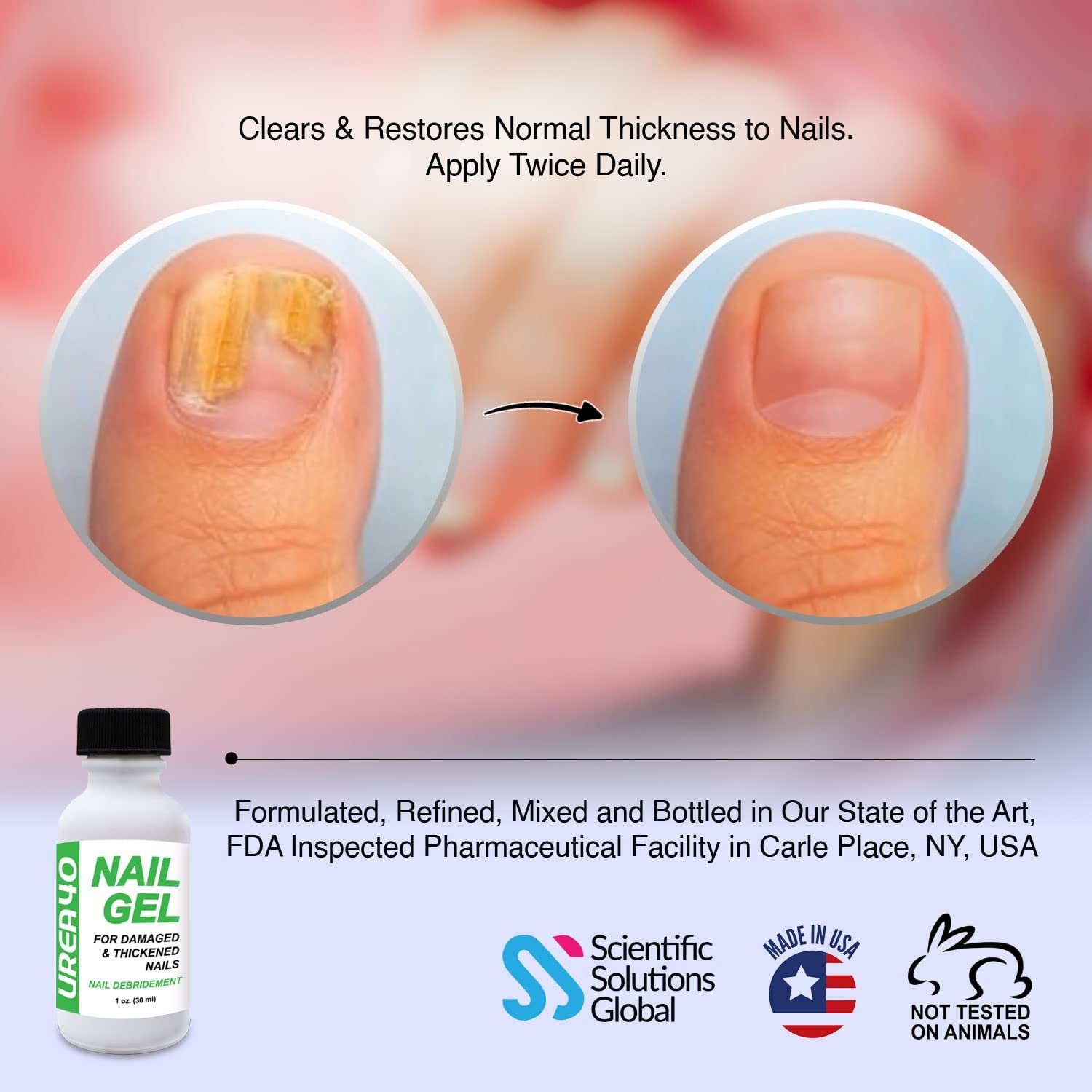 Urea Nail Gel - Softens Cracked Heel Calluses & Thick Toenails - Repairs Fungal Damaged, Yellow, Discolored Nails – Highly Effective & Quick-Dry Fingernails & Toenail Fungus Treatment | Made in USA - Image 3