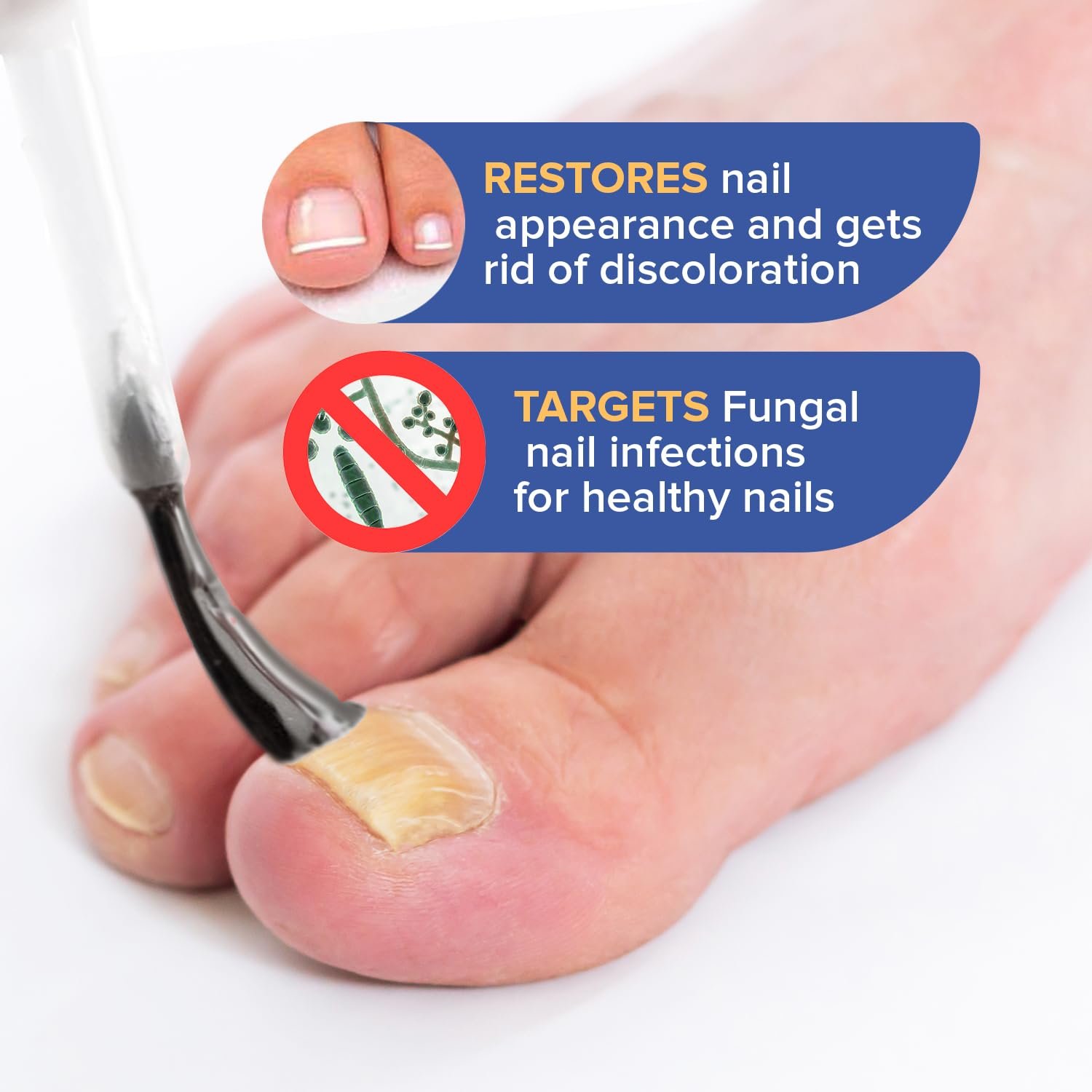 Toenail Fungus Treatment for Nail Repair: Toenail Fungus Treatment Extra Strength for Athlete's Foot of Discolored Damaged Nails Care At Home (30ml) - Image 4