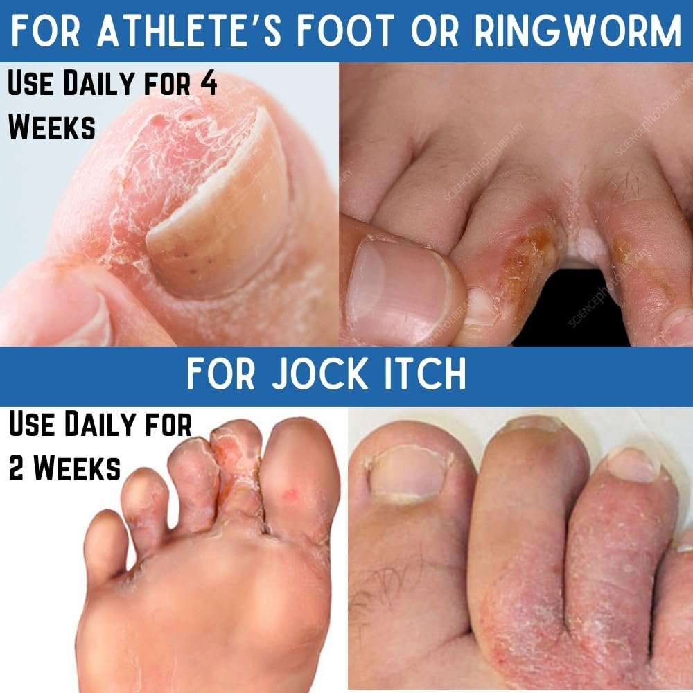 Toenail Fungus Treatment Extra Strength - FDA-Compliant,Made In USA-Toe Nail Fungus Treatments, Discolored or Brittle Nails -Nail Care Fl Oz 1.0 (30 ml) - Image 8