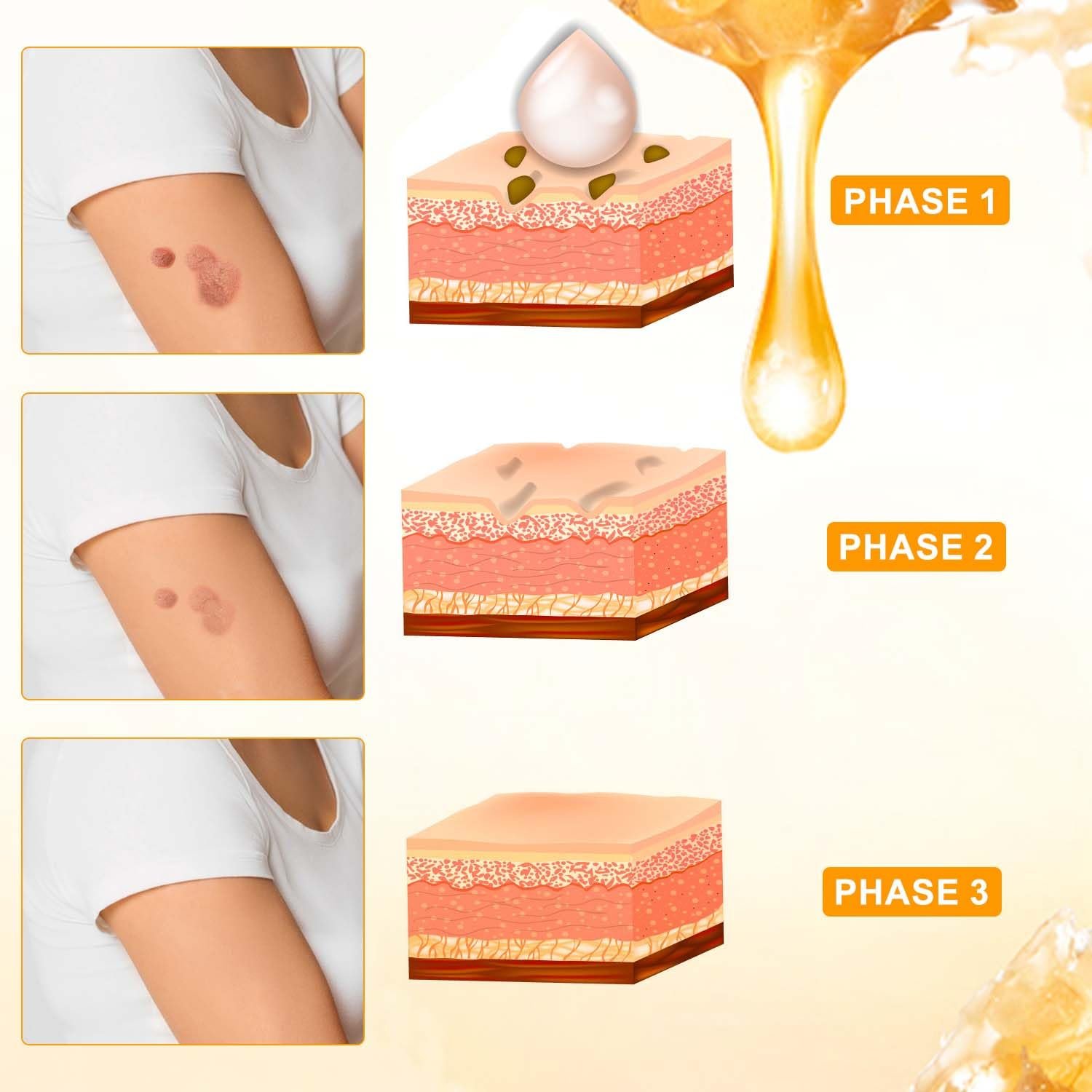 2Pcs Bee Venom Treatment Cream,2024 Professional Bee Venom Repair Cream,Bee Venom Cream Hydrating Moisturizing Treatment Cream for Men&Women - Image 6