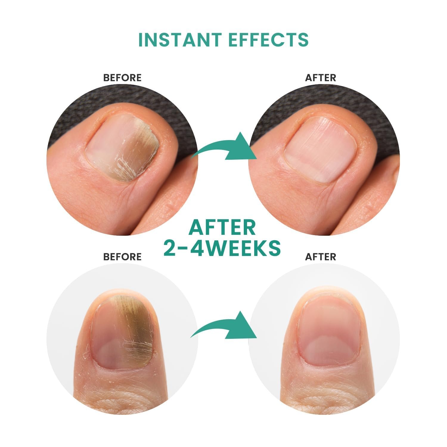 Toenail Fungus Treatment: Extra Strength Nail Fungus Treatment for Toenail & Fingernail, Nail Repair Solution for Thick Broken Discolored & Damaged Nail - Image 6