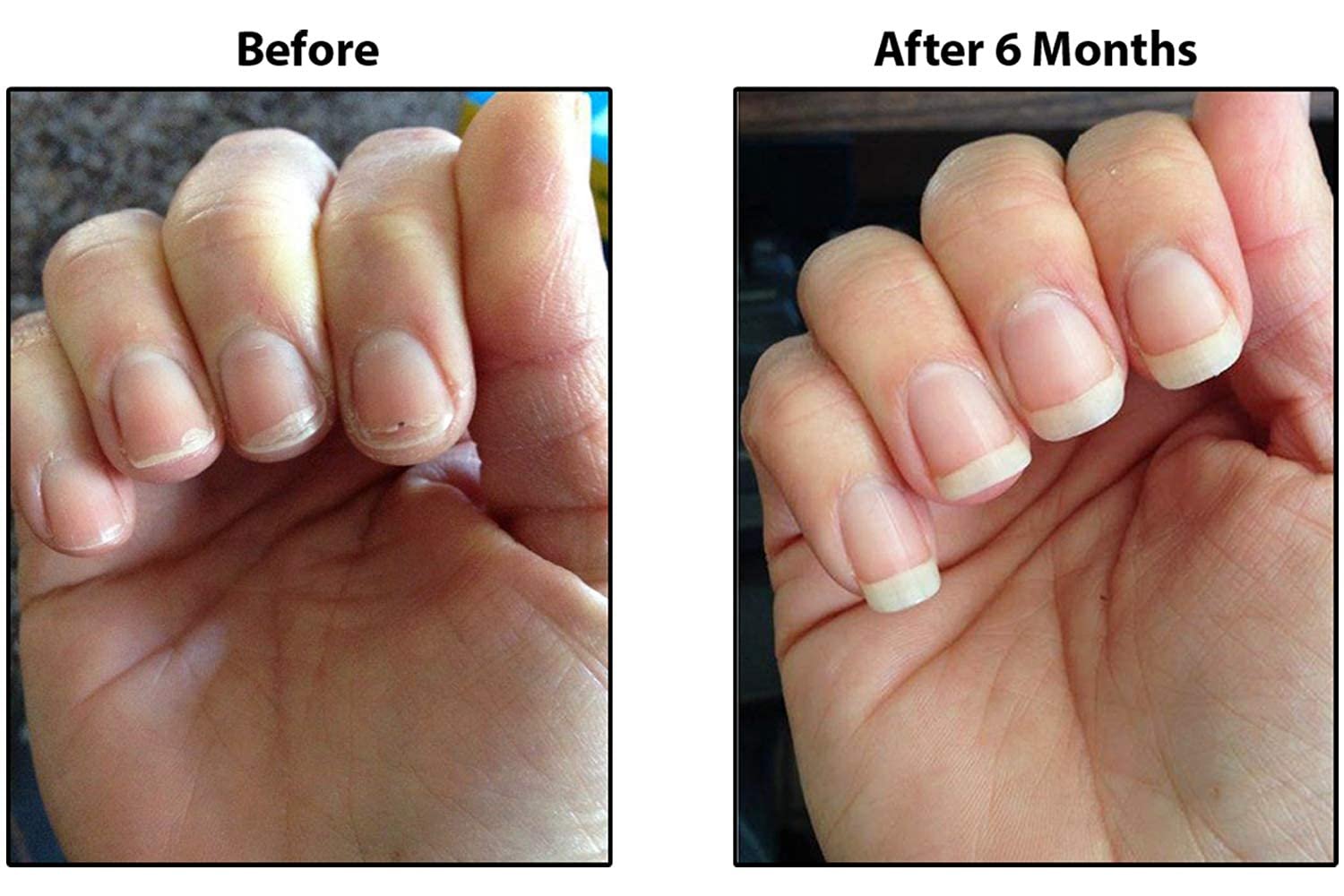 TIPS Nail Conditioner 3 Pack - Image 4