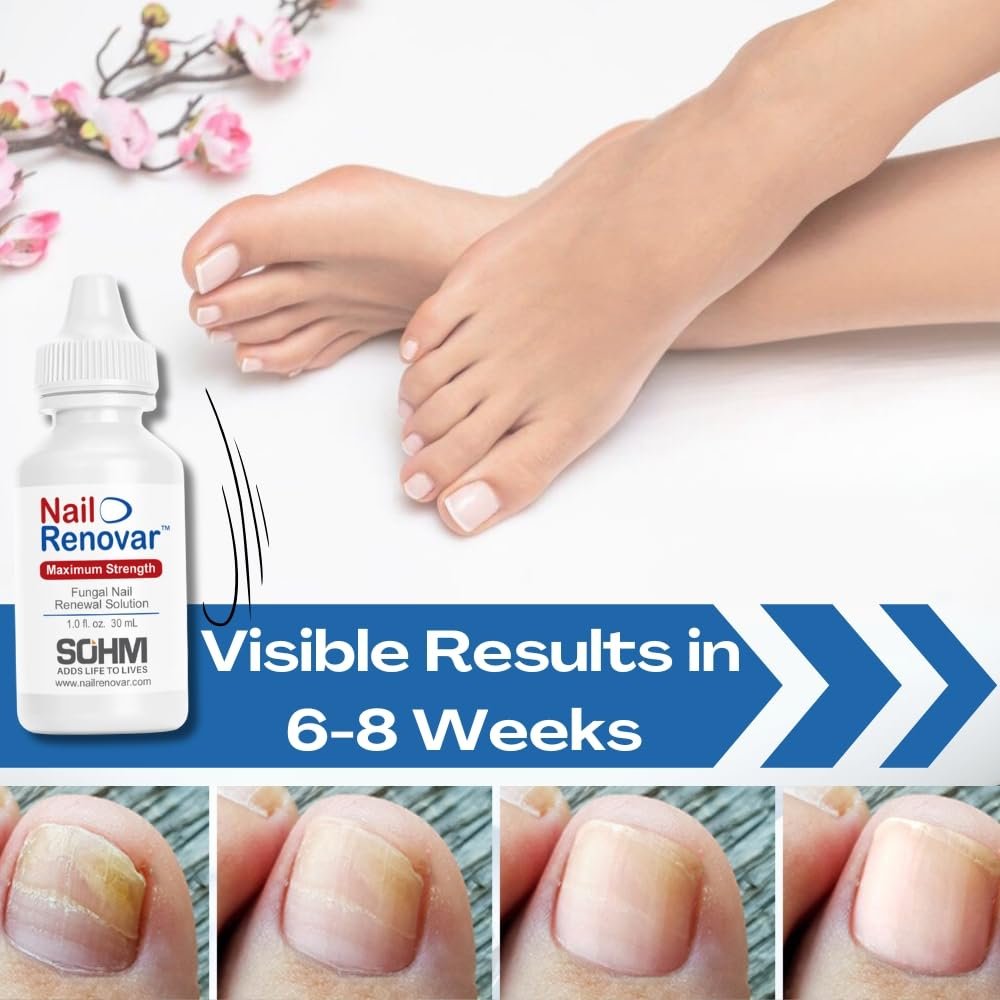 Toenail Fungus Treatment Extra Strength - FDA-Compliant,Made In USA-Toe Nail Fungus Treatments, Discolored or Brittle Nails -Nail Care Fl Oz 1.0 (30 ml) - Image 7