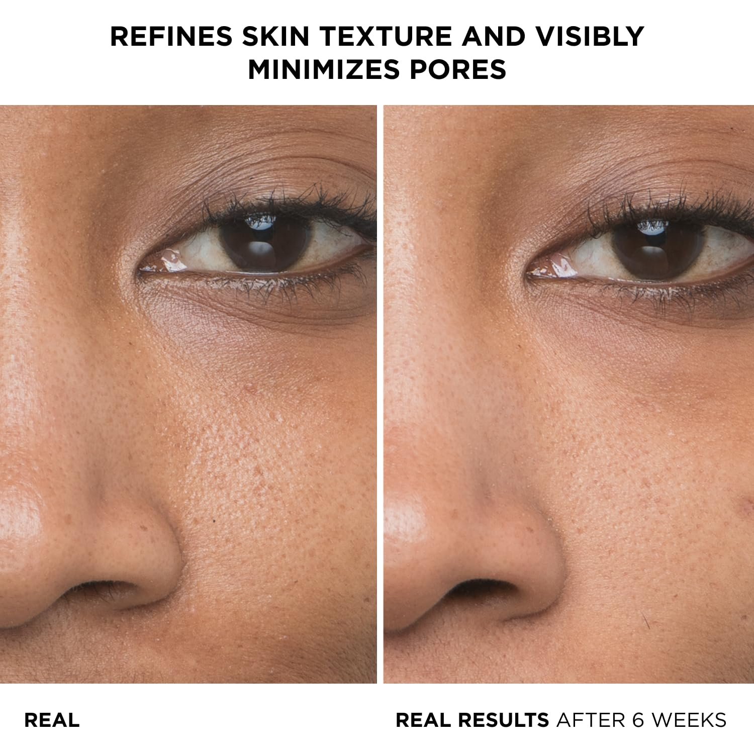 IT Cosmetics Bye Bye Pores 10% Glycolic Acid Face Serum - Visibly Minimizes Pores In 1 Week & Gently Exfoliates to Help Refine Skin’s Texture - With Hyaluronic Acid for Hydration -1 Fl. Oz - Image 3