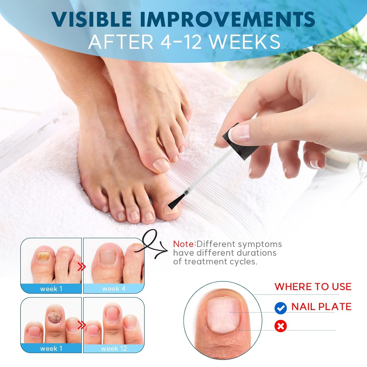 Toenail Fungus Treatment,Toe Fungus Nail Treatment Extra Strength Fast Acting, Toe Fungus Treatment for Toenail, Toenail Fungus Treatment Extra Strength. (2Pcs) - Image 6