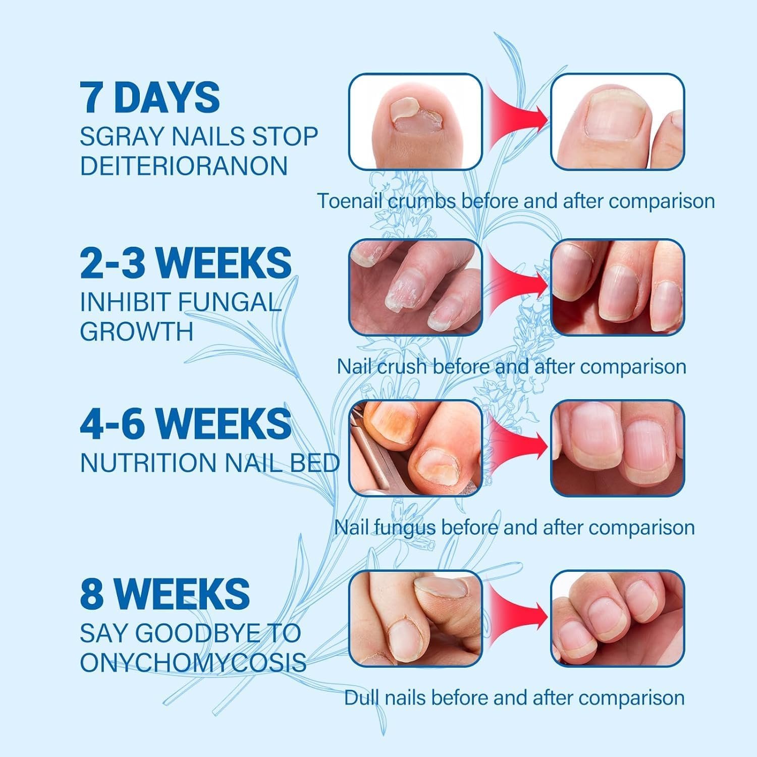 Toenail Fungus Treatment, Toe Nail Fungus Treatment for Toenail & Fingernails, Extra Strength Effective Enhancing Nail Repair for Finger & Toenail Safely & Gently Nail Repair, Toenail Softener -30ML - Image 7