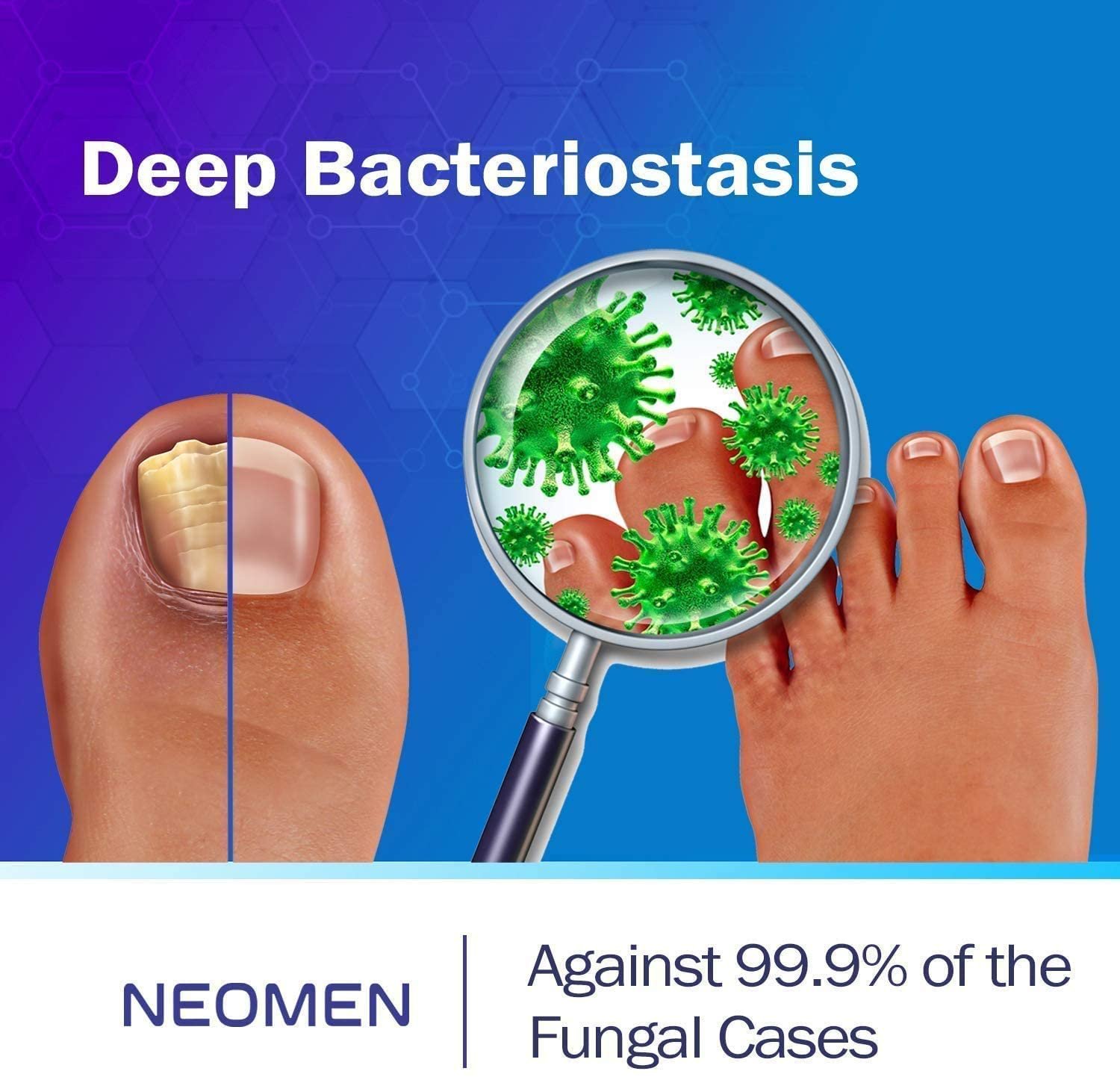 Nail Fungus Treatment Pen, Nail Fungus Treatment for Toenail Pen, Toenail and Nail Care, Nail Support by Neomen (4 Pcs) - Image 7