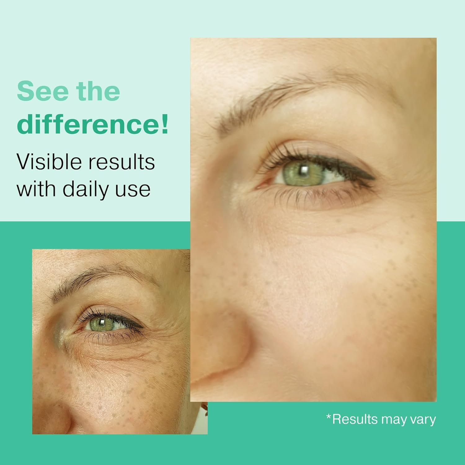 2X BIGGER 2OZ, Go Radiance 5% Glycolic Acid Serum, Salicylic Acid Serum for Acne-prone Skin, BHA Liquid Exfoliant, AHA Peel Lactic Acid Serum, Gentle Glycolic Acid Peel For Oil Control & Pore Reducer - Image 5