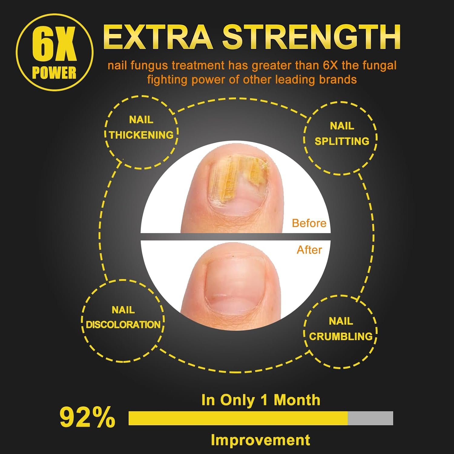 Toenail Fungus Treatment,Nail Fungus Treatment Extra Strength for Athletes Foot, Thick, Broken, Discolored & Damaged Nail - Woman and Man - 30mL - Image 4