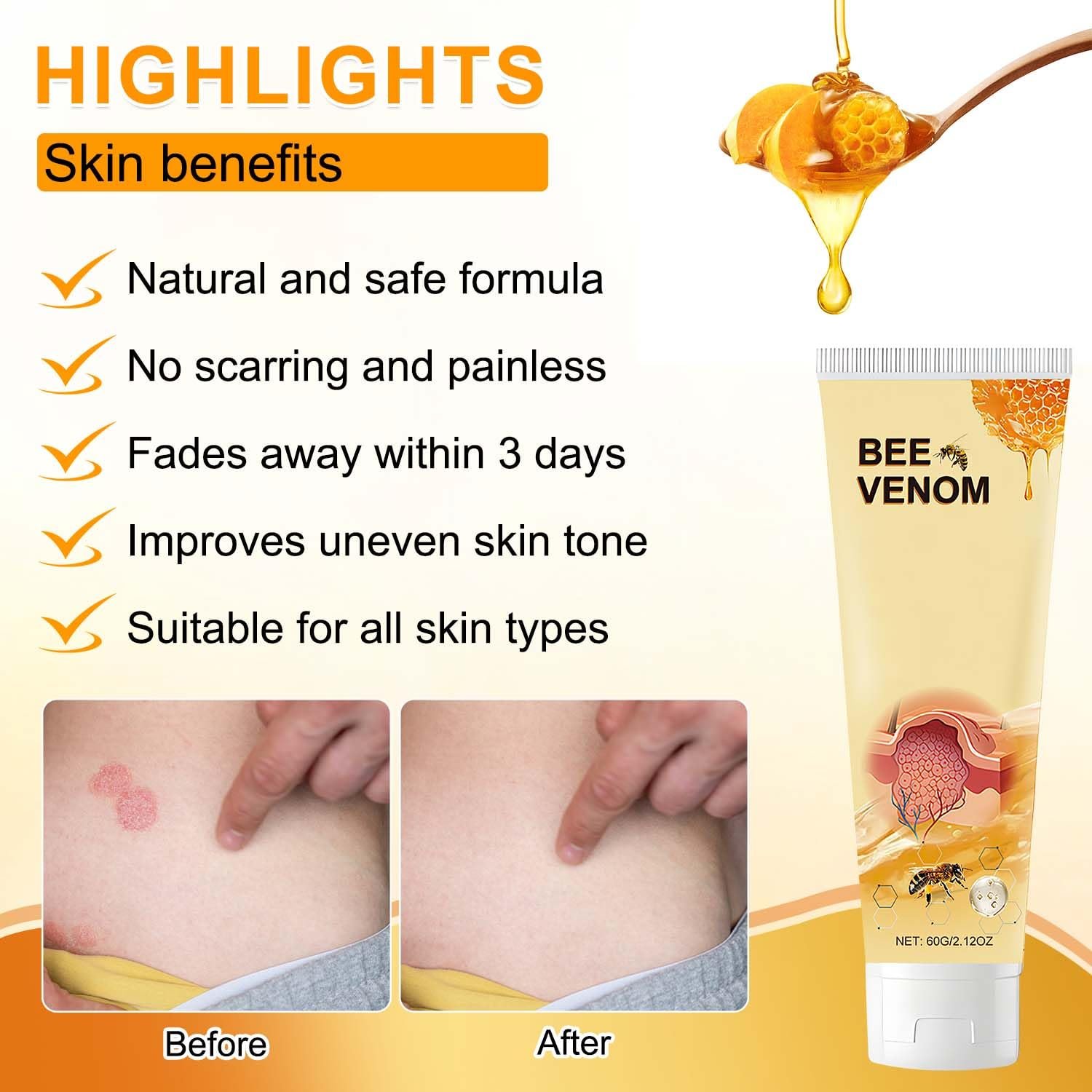 2Pcs Bee Venom Treatment Cream,2024 Professional Bee Venom Repair Cream,Bee Venom Cream Hydrating Moisturizing Treatment Cream for Men&Women - Image 4