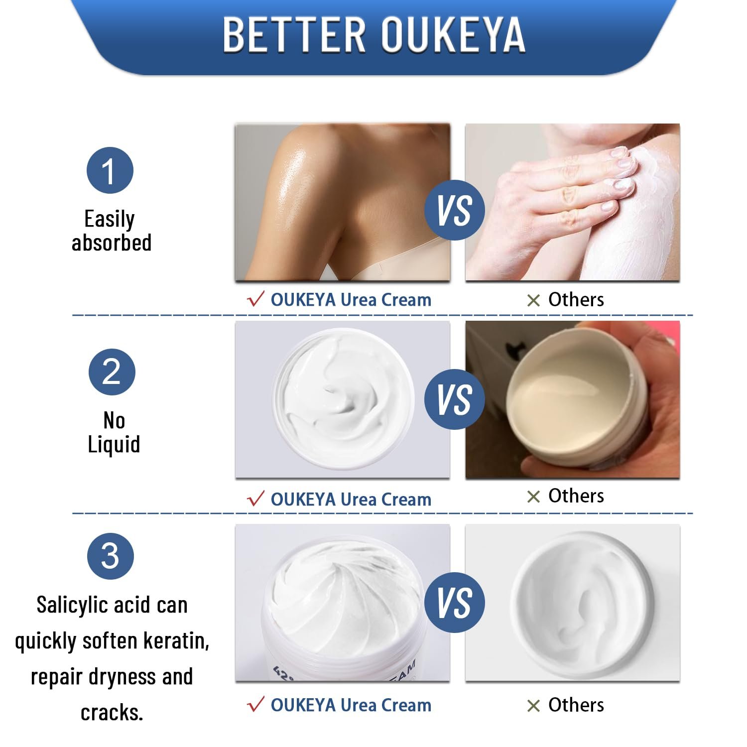 Urea Cream 42% plus Salicylic Acid 2% Net 5.29 Oz for Dry Cracked Feet, Heels, Knees, Elbows, Hands Repair Treatment. Moisturizes and Removes Corns, Calluses, Dead Skin, and Softens Toenails - Image 6