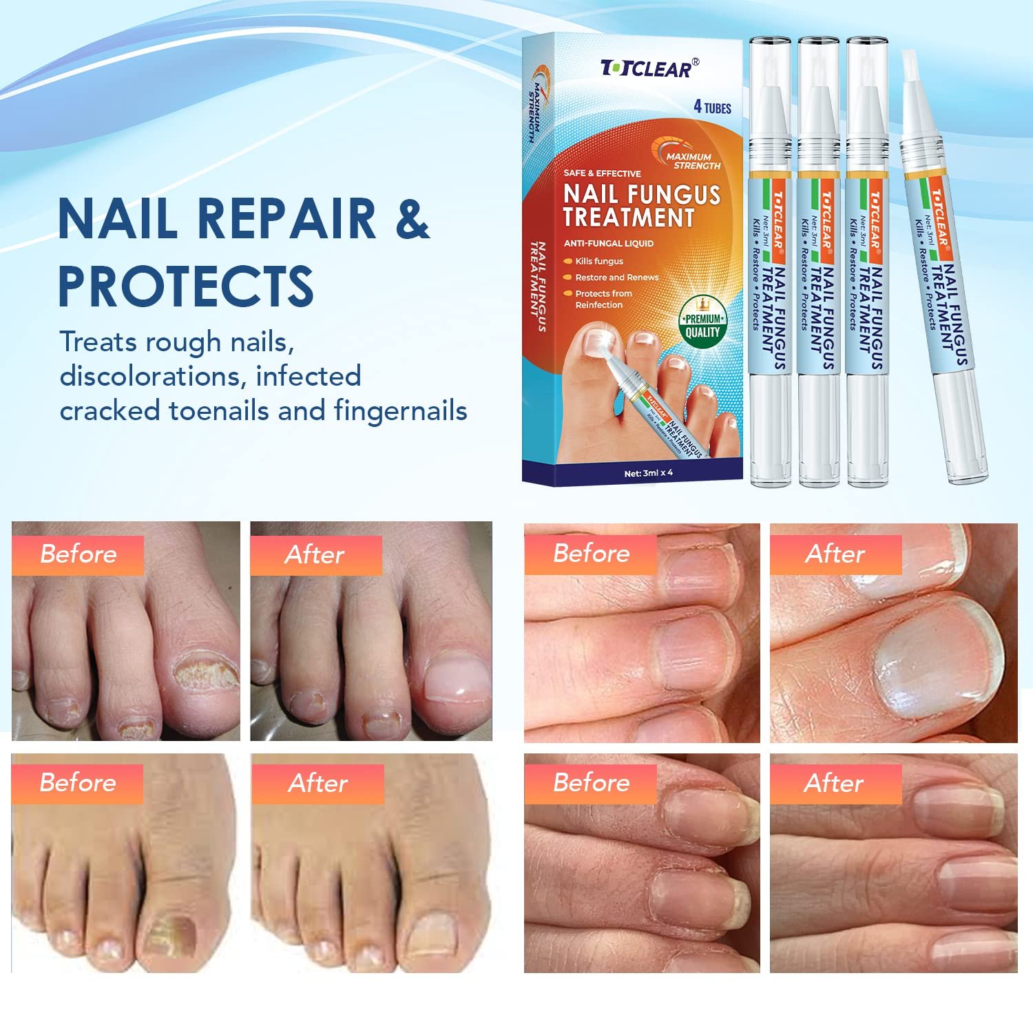 Nail Repair Pens for Toenail and Fingernail, Toenail Fungus Treatment, Nail Fungus Treatment For Toenail, Nail Repair, Fungus Nail Treatment, Toe Nail Fungus Treatment Extra Strength - 4 PENS - Image 3