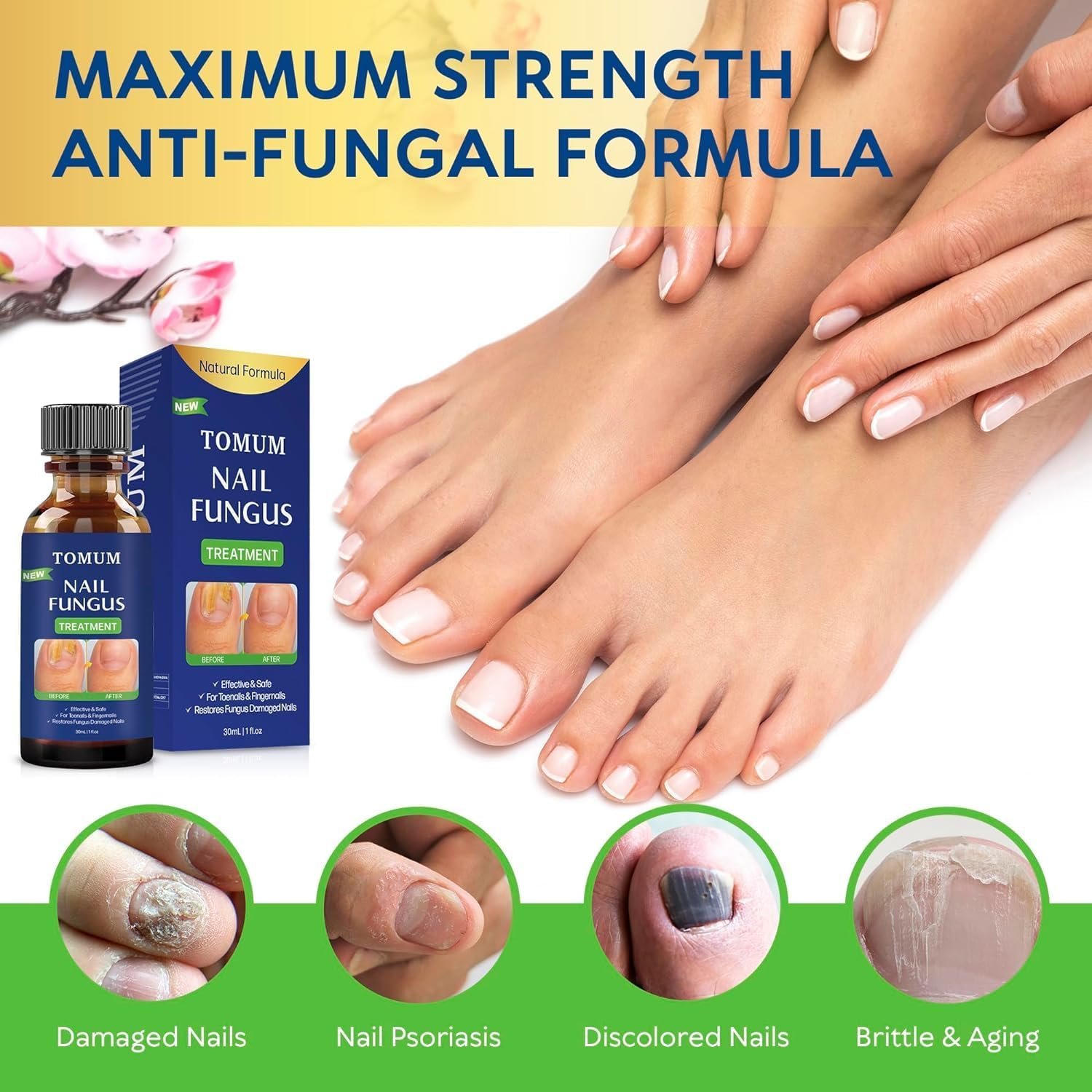 Extra Strength Toenail Fungus Treatment: Nail Fungus Treatment for Toenail, Toenail Fungus Treatment Extra Strength - Nail Fungus Treatment, Safely and Gently - 30ML - Image 6